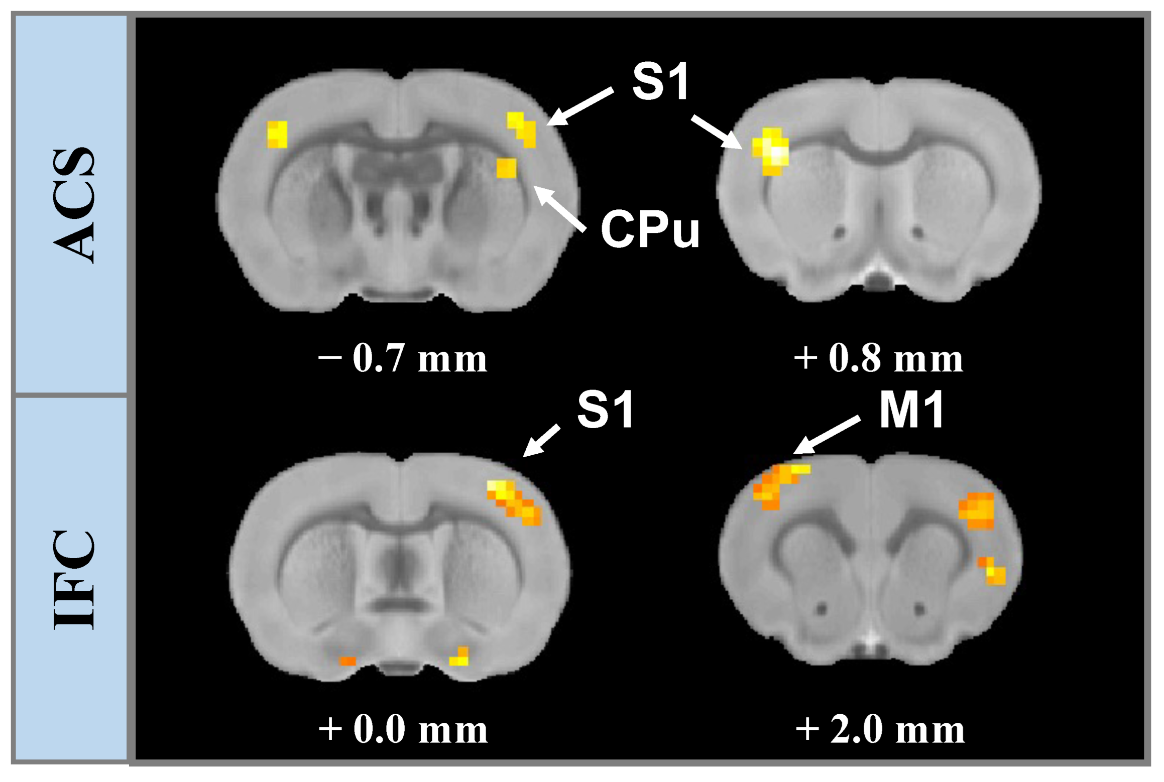Brainsci 13 01317 g006
