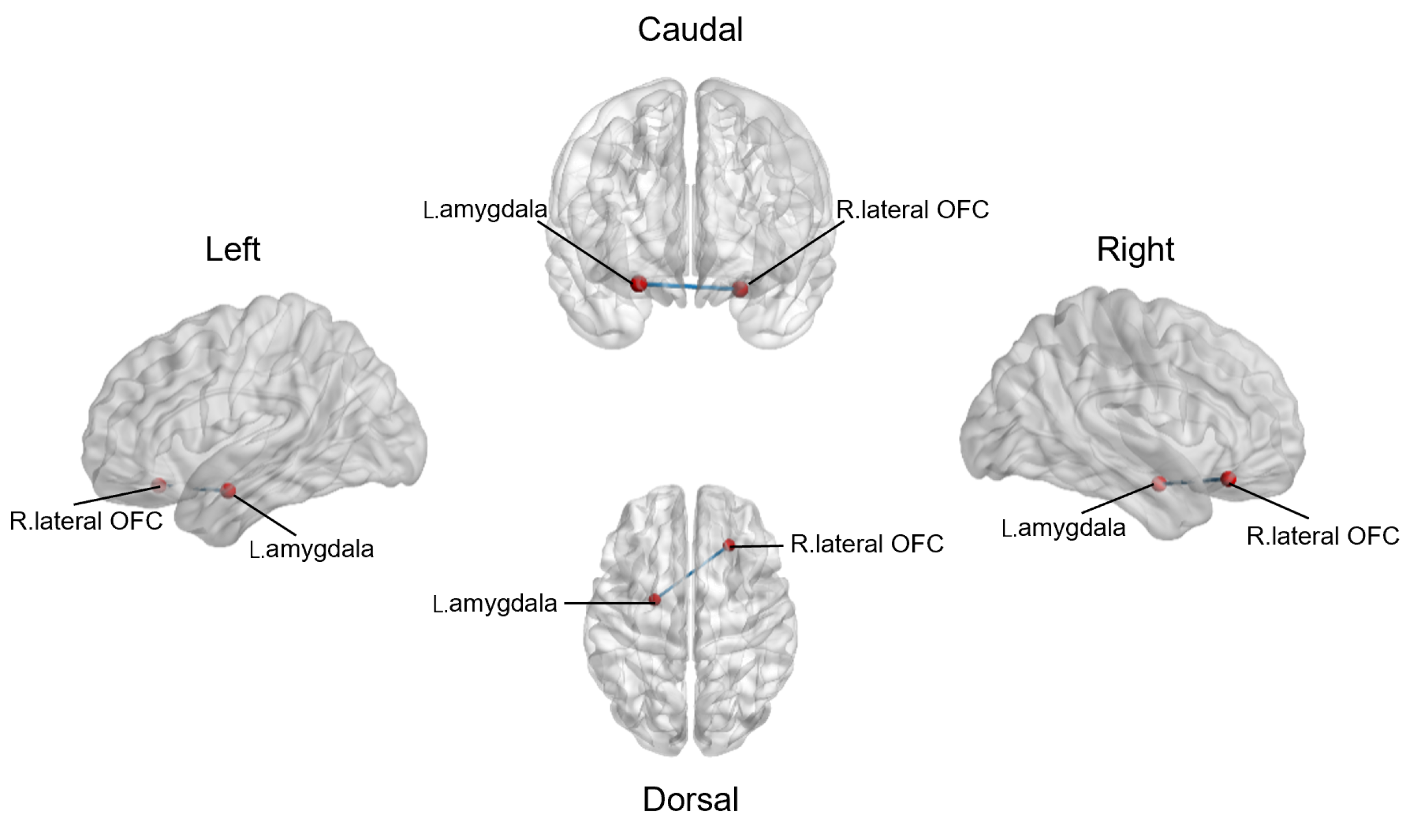 Brainsci 13 01403 g004