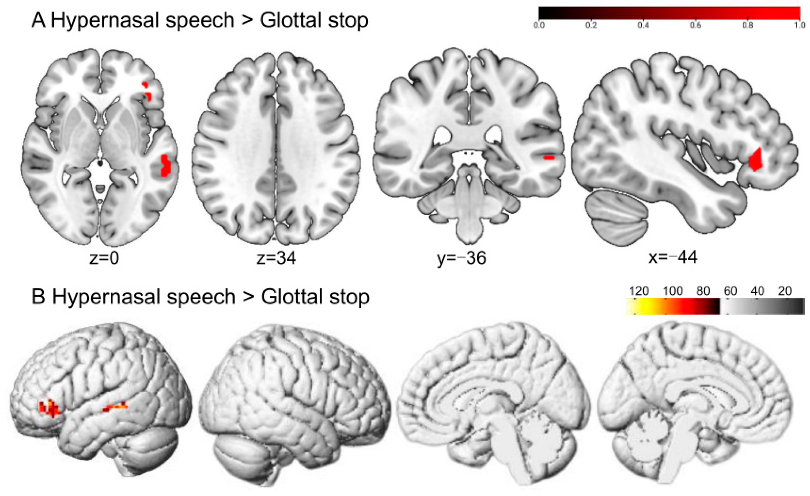 Brainsci 13 01506 g004