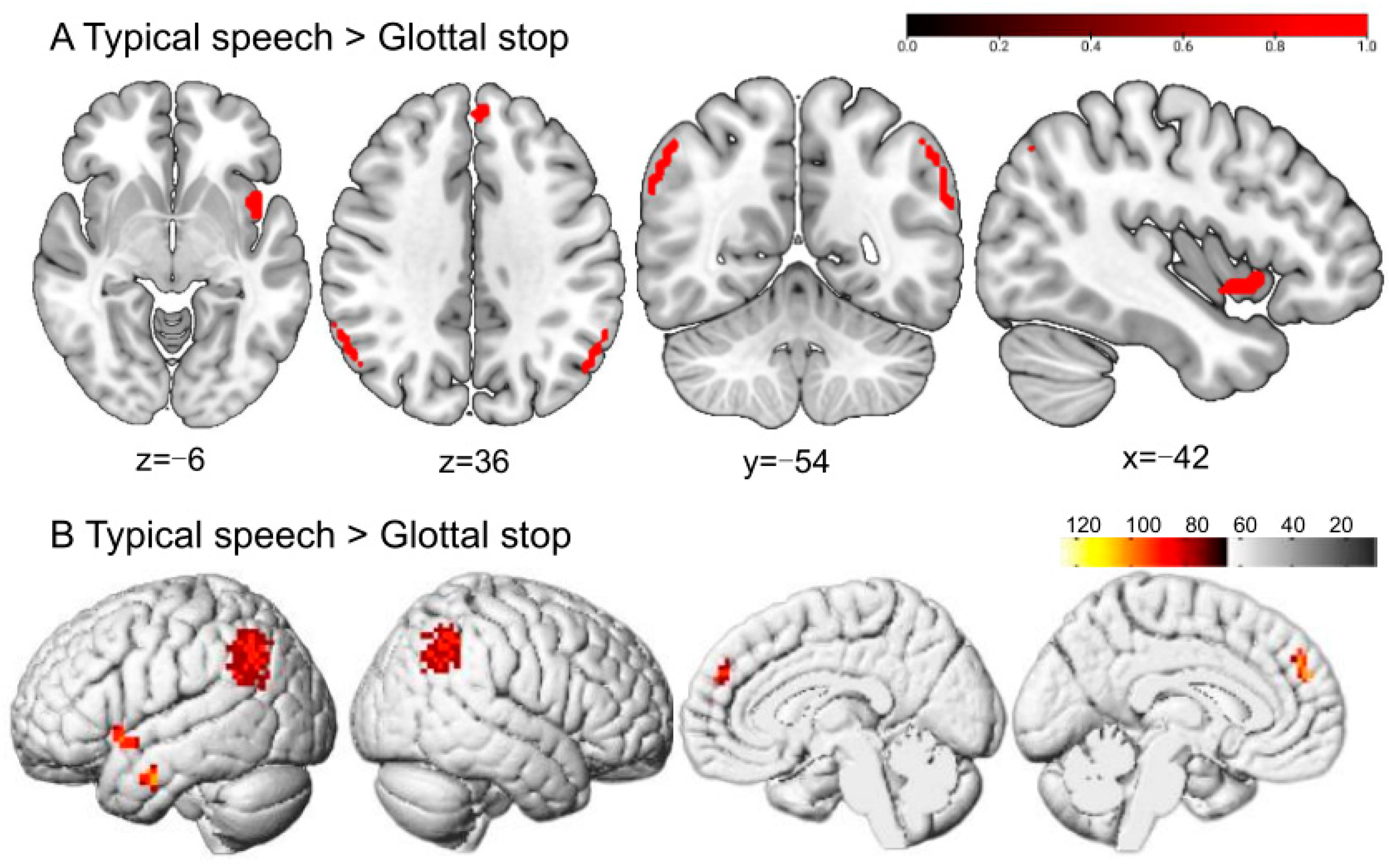 Brainsci 13 01506 g005