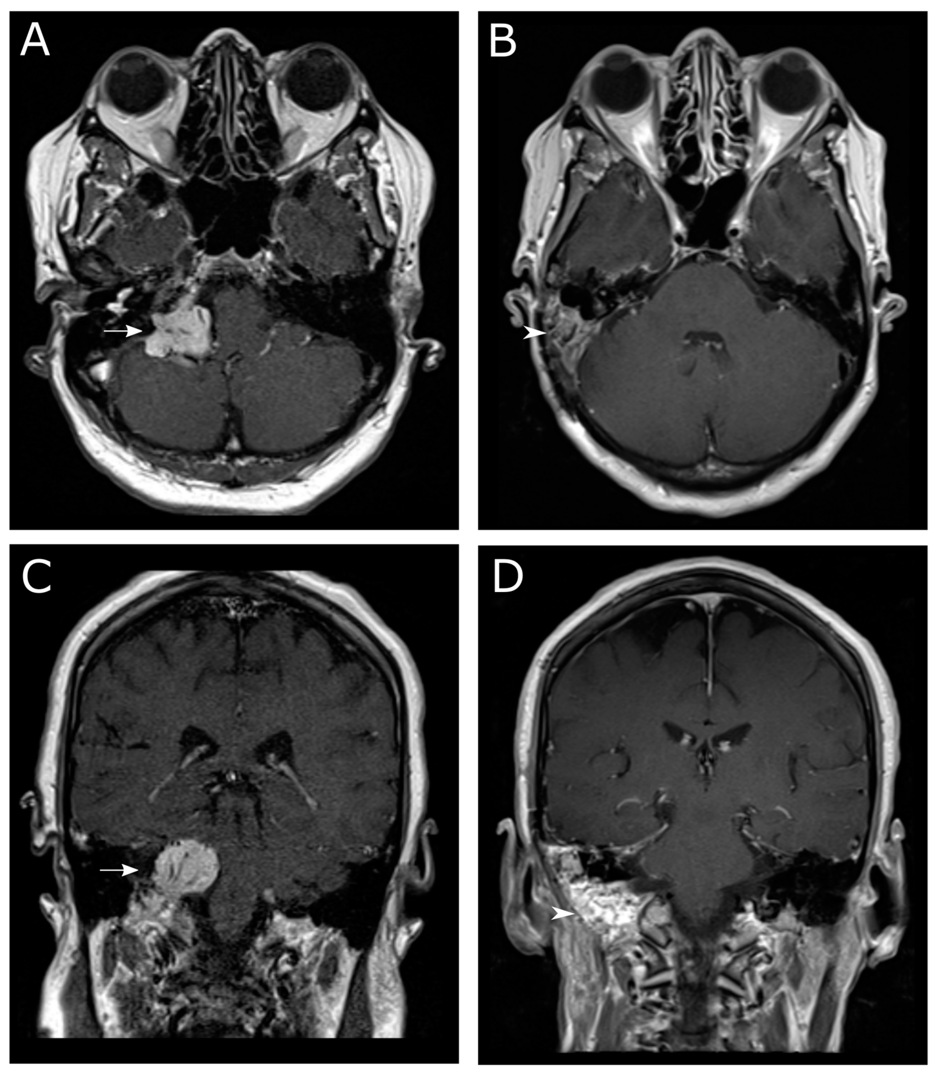 Brain Sciences, Free Full-Text