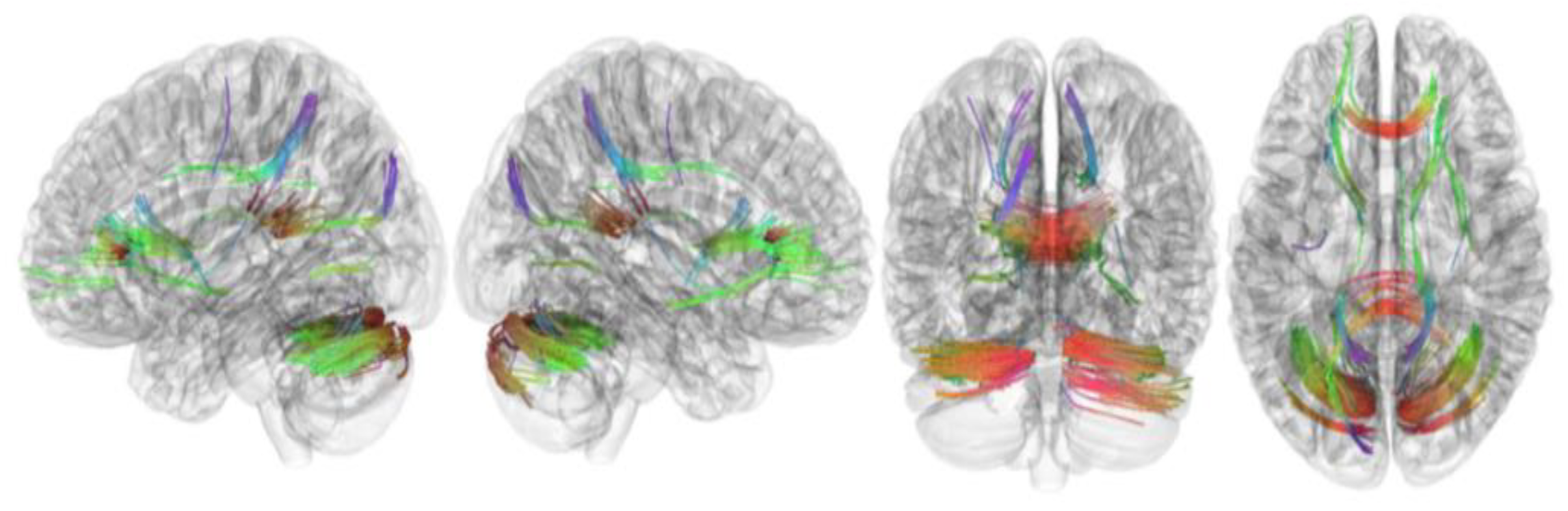 Brainsci 13 01560 g002