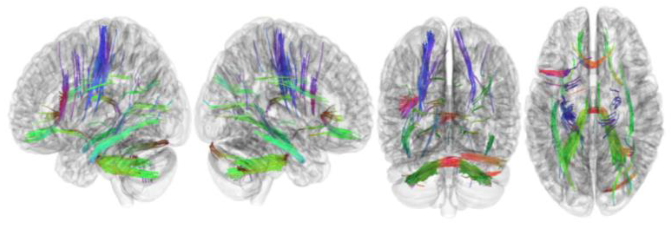 Brainsci 13 01560 g003