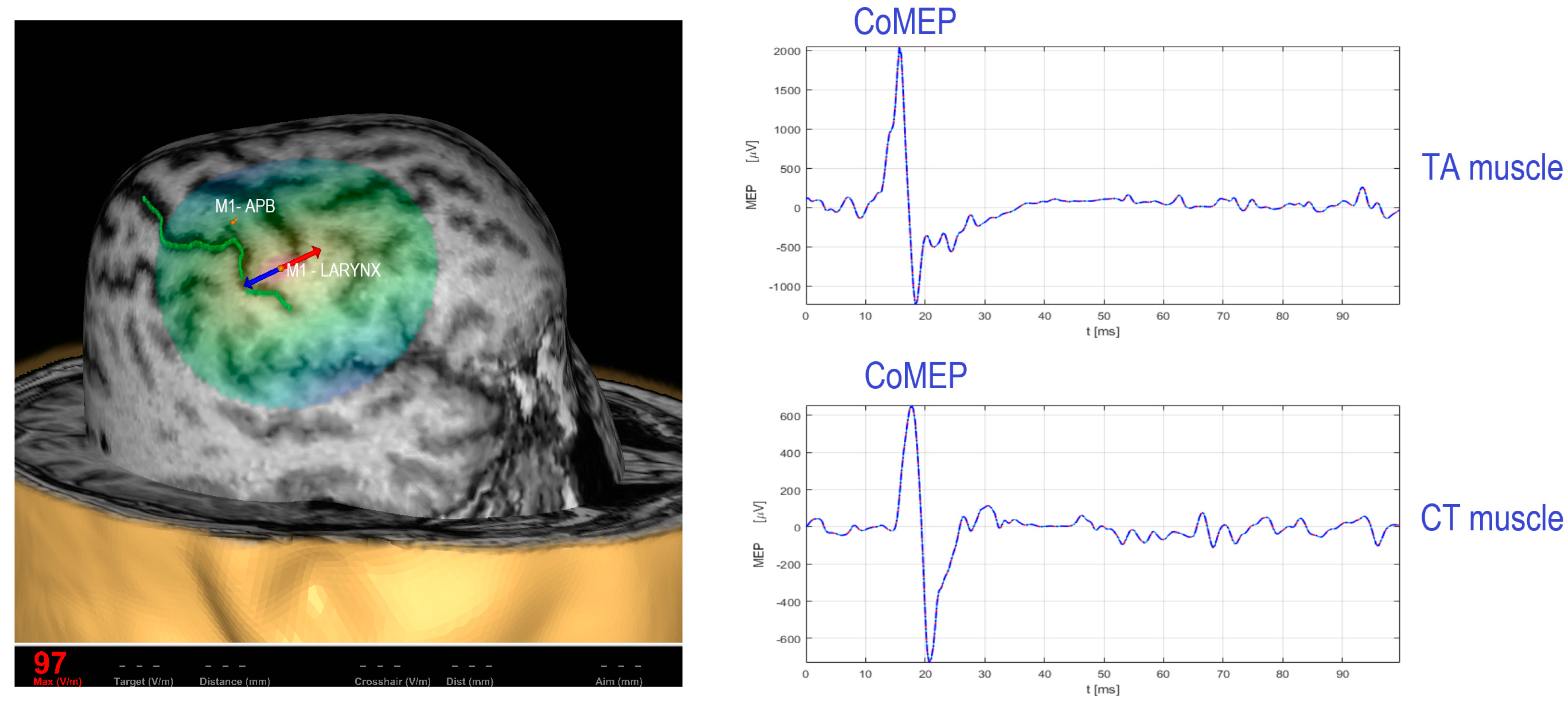 a Neurophysiological mechanisms of electrical stimulation of muscles