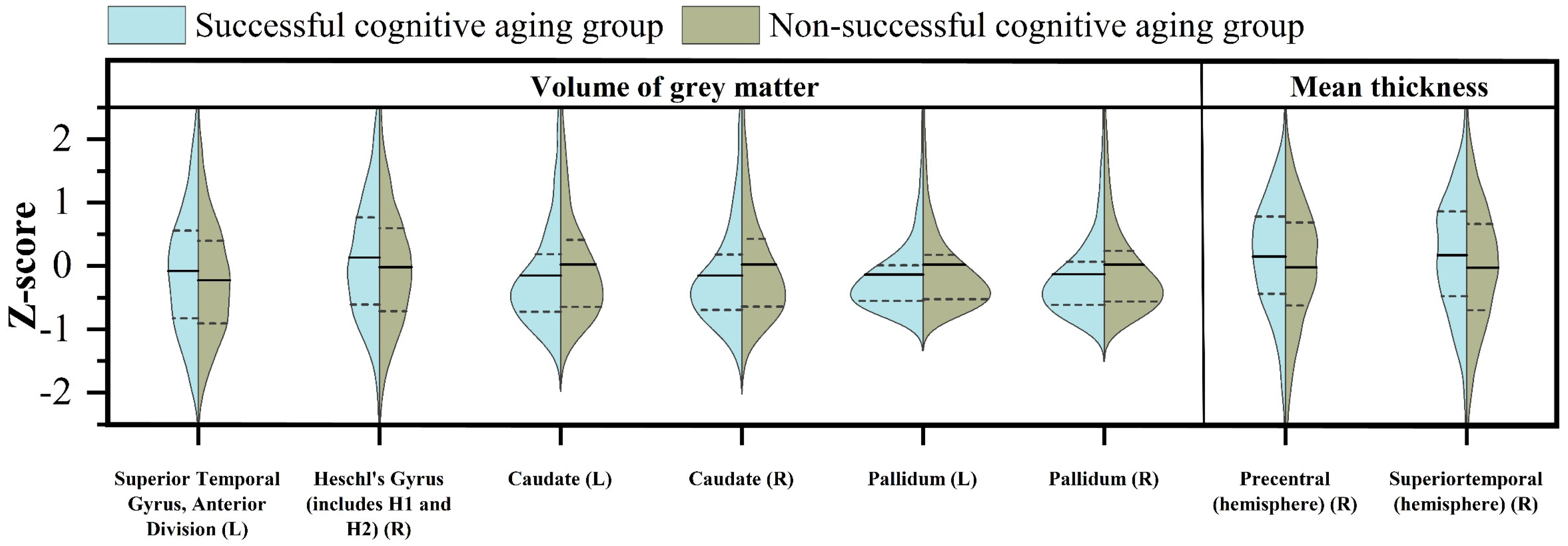 Scientists Identify Drivers of Brain Aging