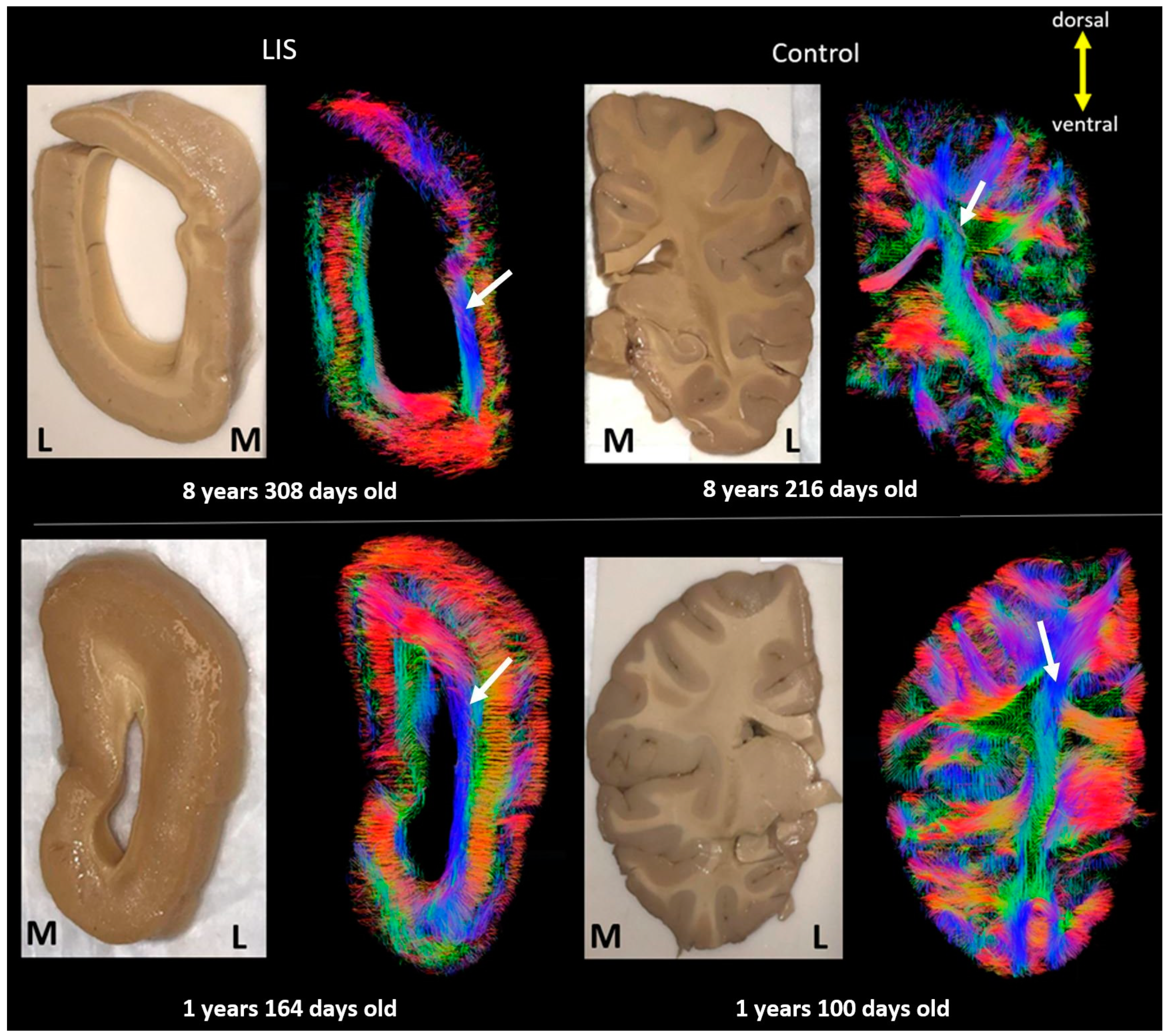 Brainsci 13 01655 g007