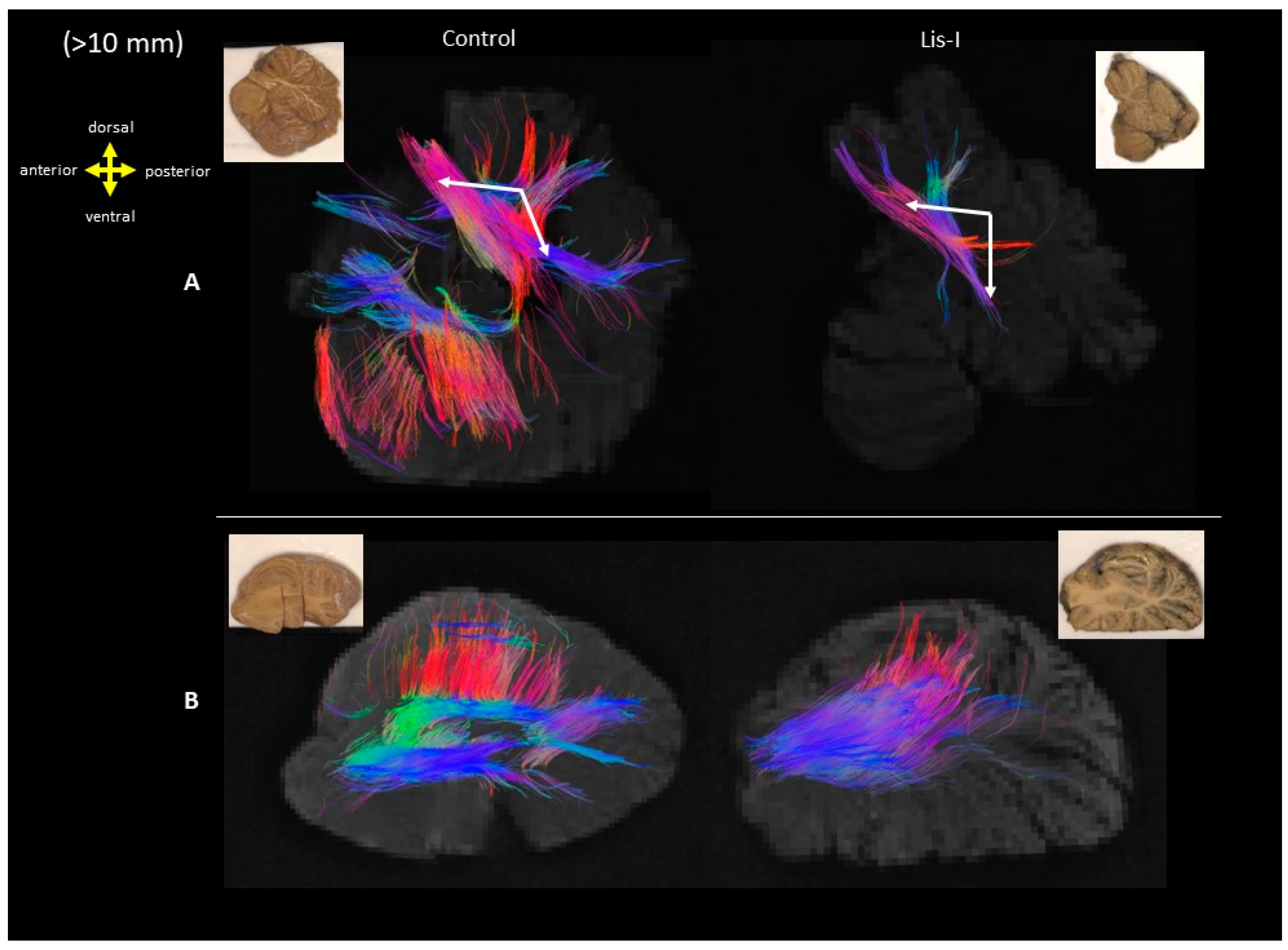 Brainsci 13 01655 g010