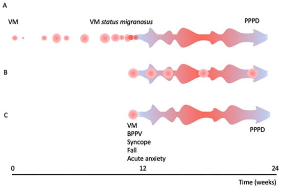 Vestibular migraine may be an important cause of dizziness/vertigo