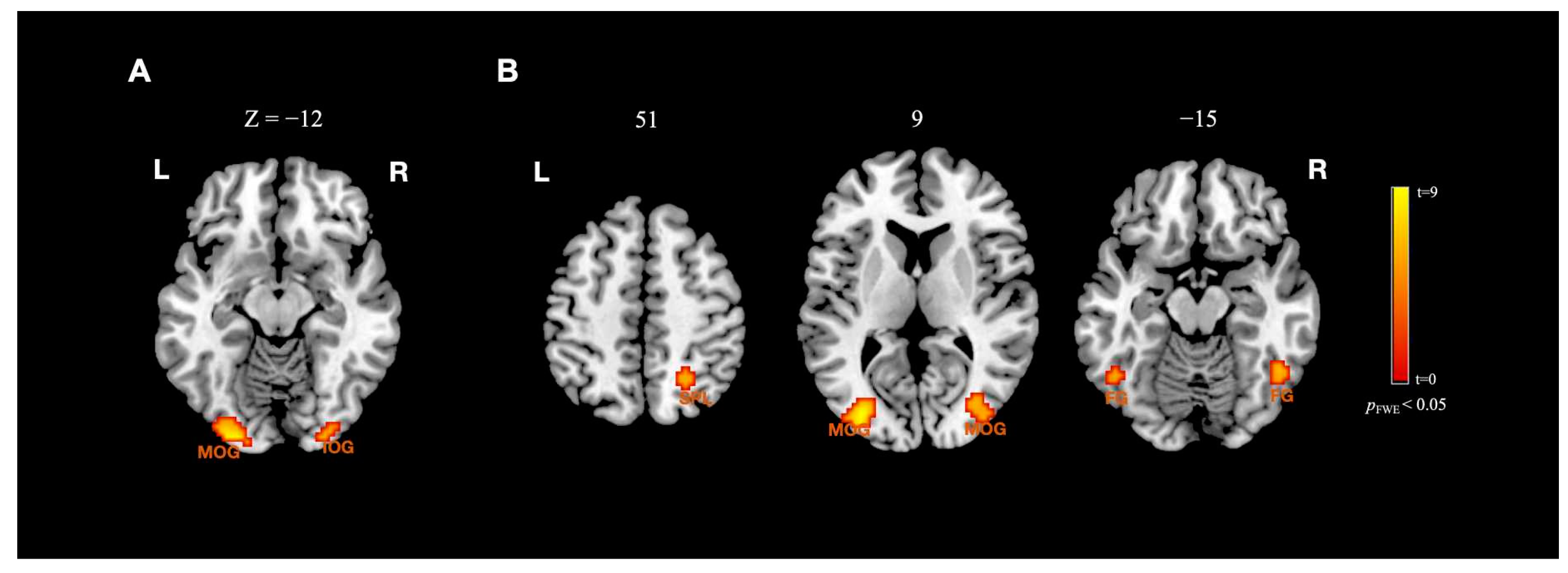 Brainsci 13 01699 g004