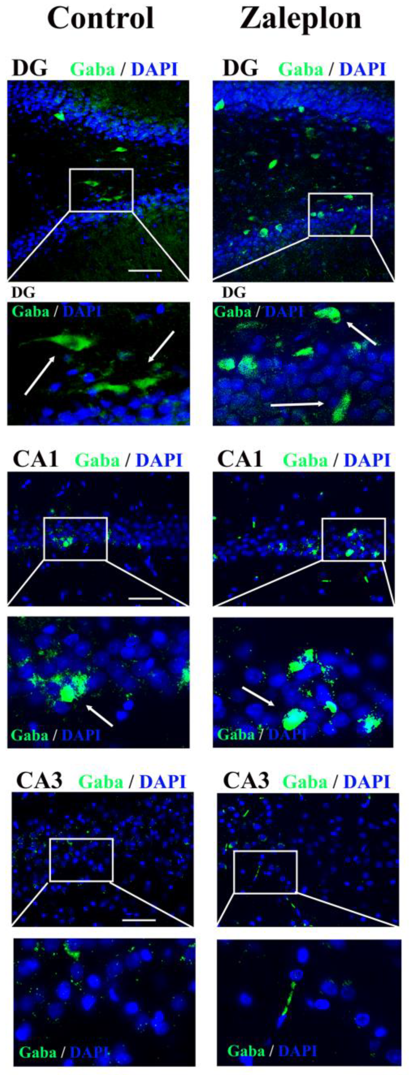 Brainsci 13 01707 g003
