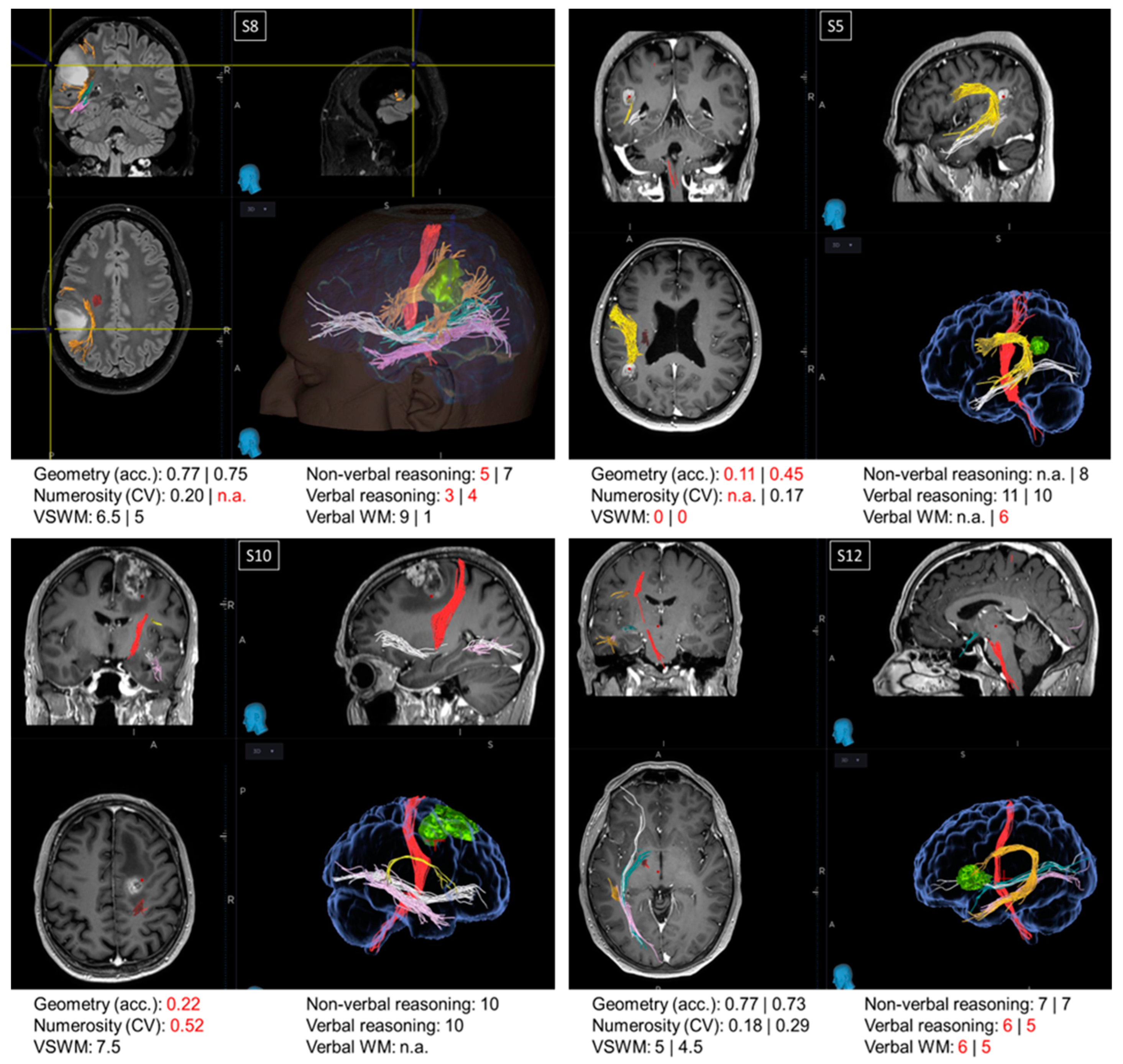 Brainsci 14 00069 g003