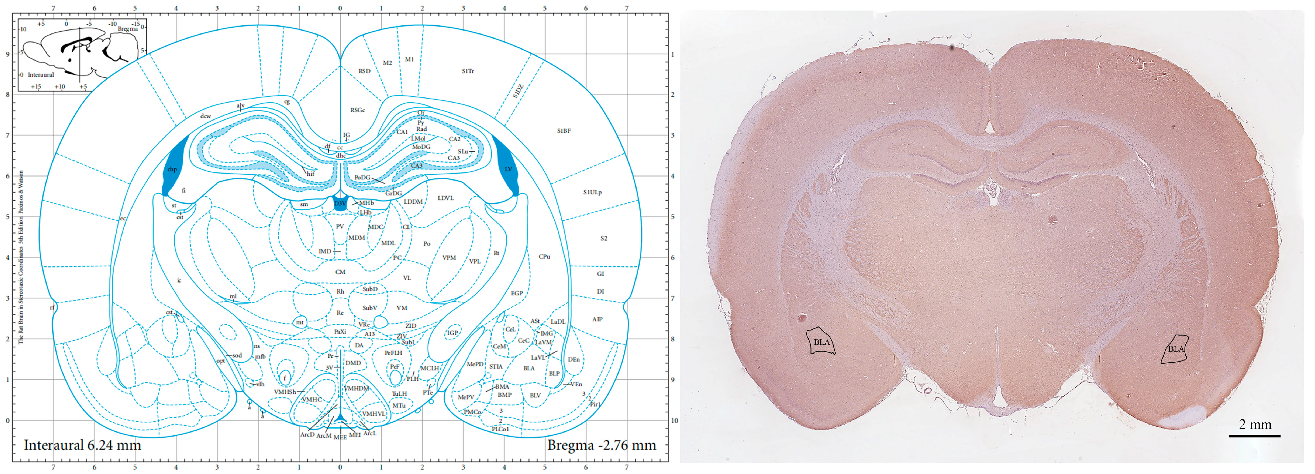 Brainsci 14 00161 g001