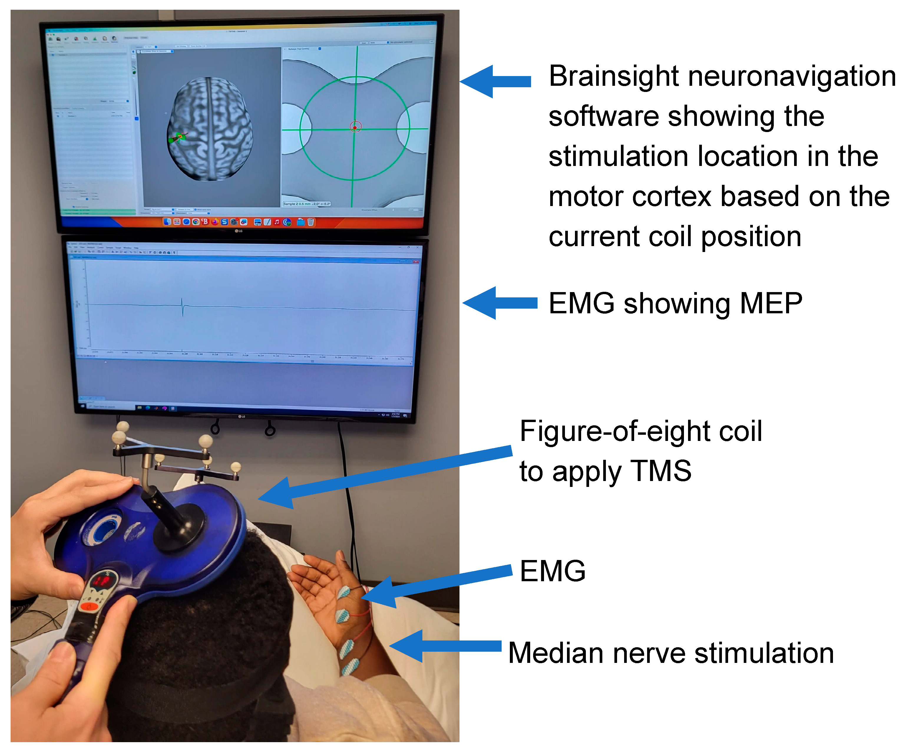 Brainsci 14 00253 g003 Brainsci 14 00253 g003