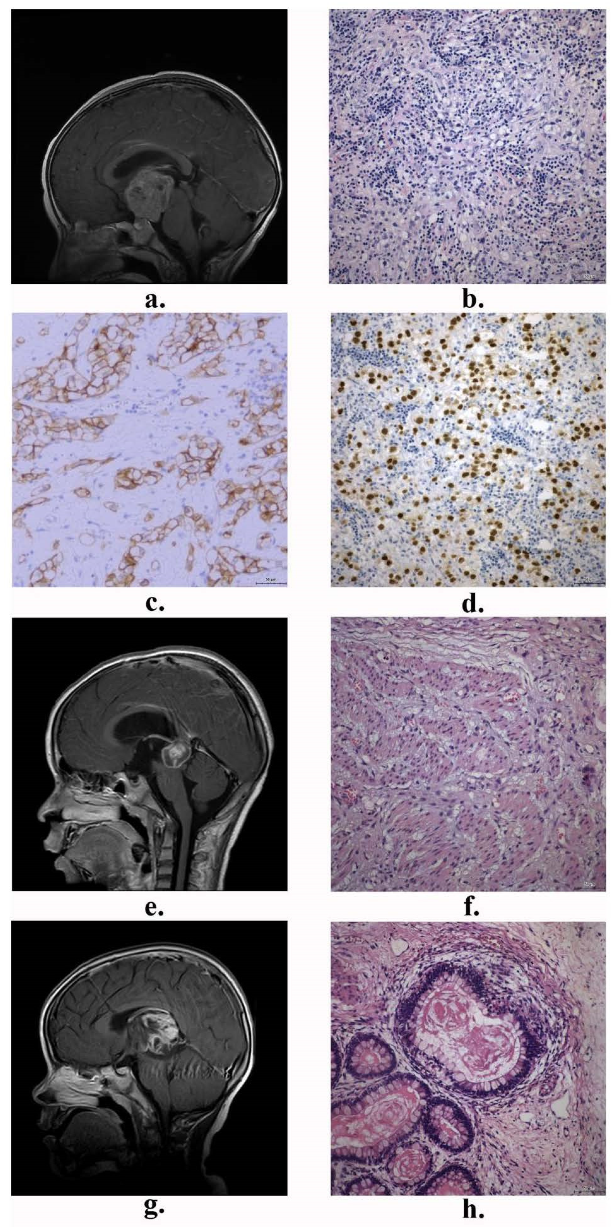 Brainsci 14 00445 g001 Brainsci 14 00445 g001