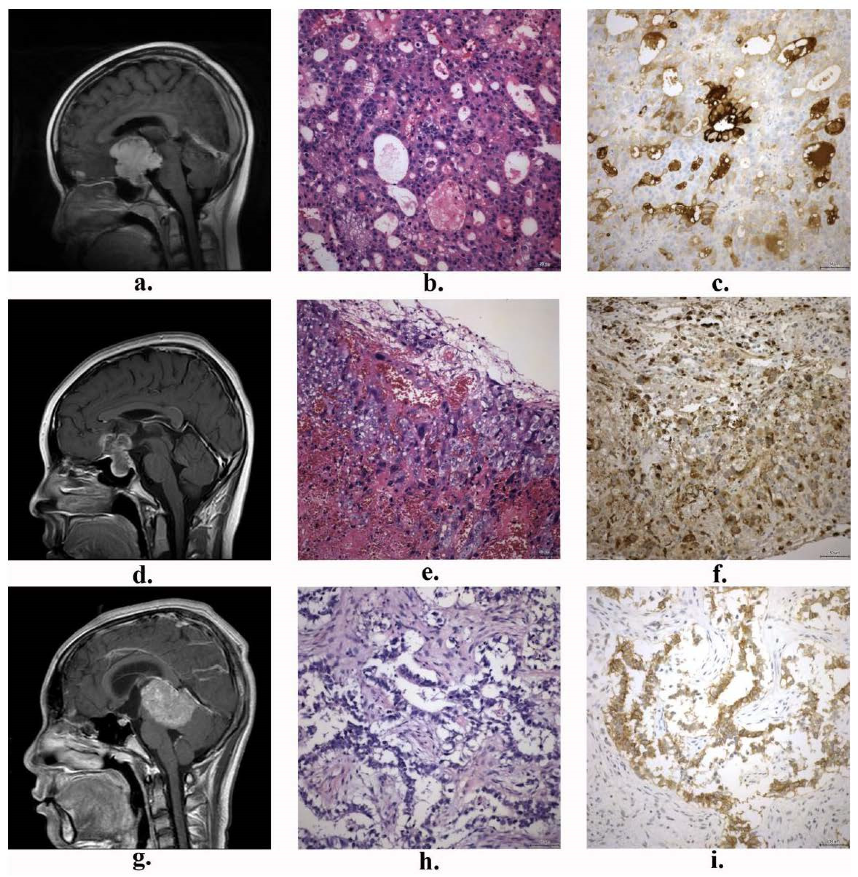 Brainsci 14 00445 g002 Brainsci 14 00445 g002