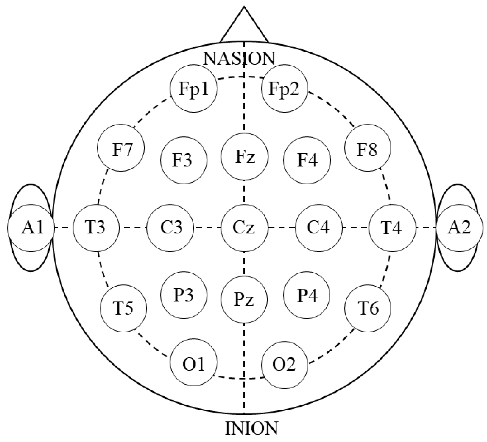 Brainsci 14 00527 g001