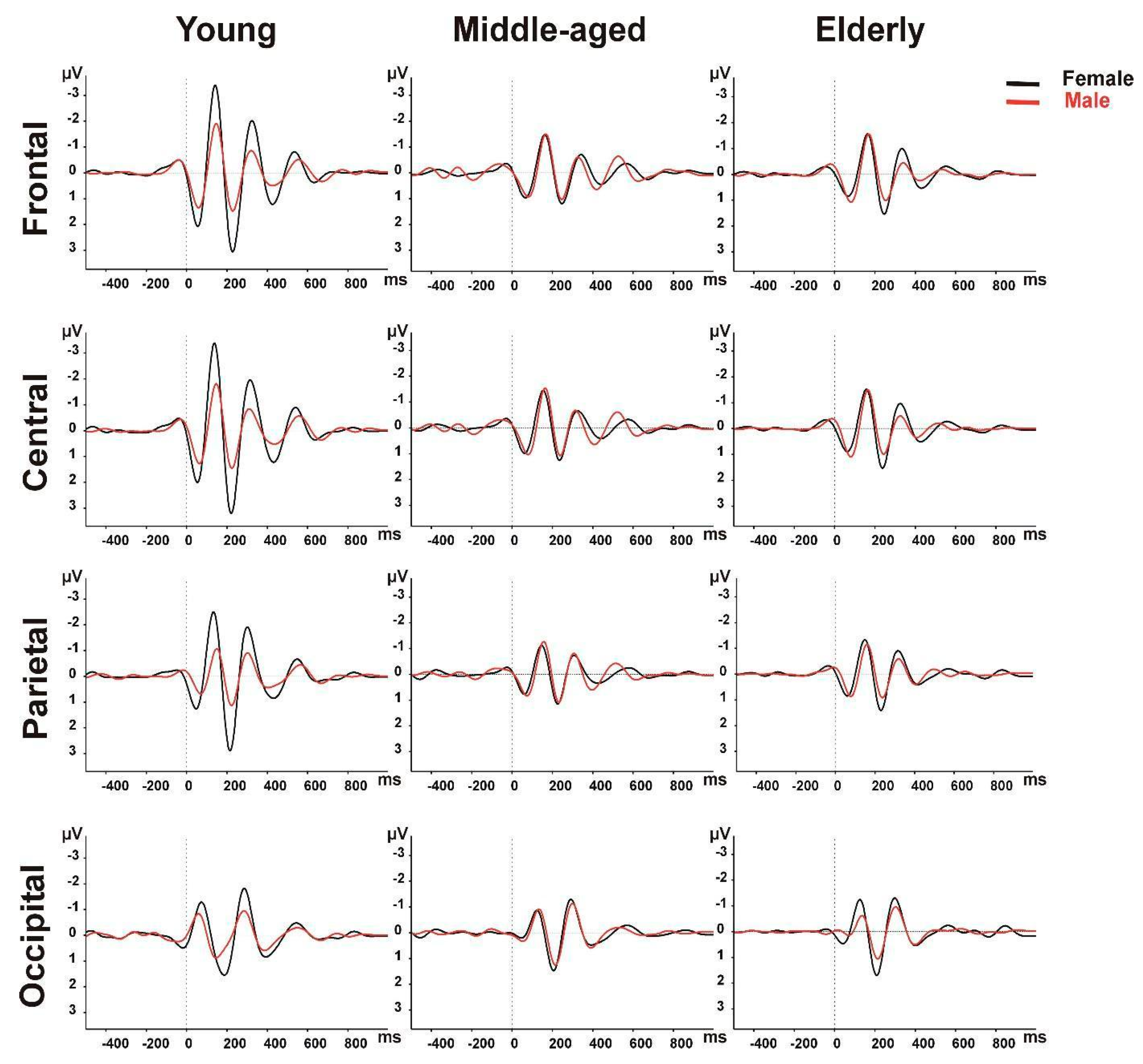 Brain Sciences | Free Full-Text | Age-Related Aspects of Sex Differences in  Event-Related Brain Oscillatory Responses: A Turkish Study