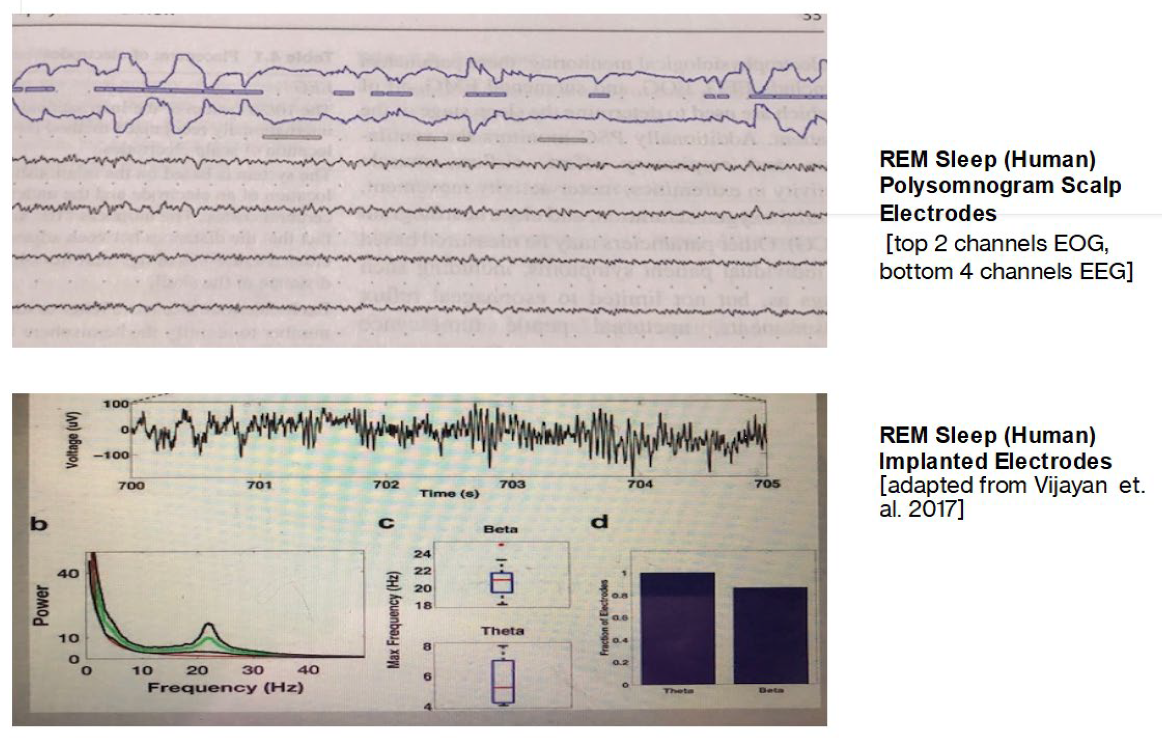 Brain Sciences | Free Full-Text | The Persistent Paradox of Rapid Eye  Movement Sleep (REMS): Brain Waves and Dreaming