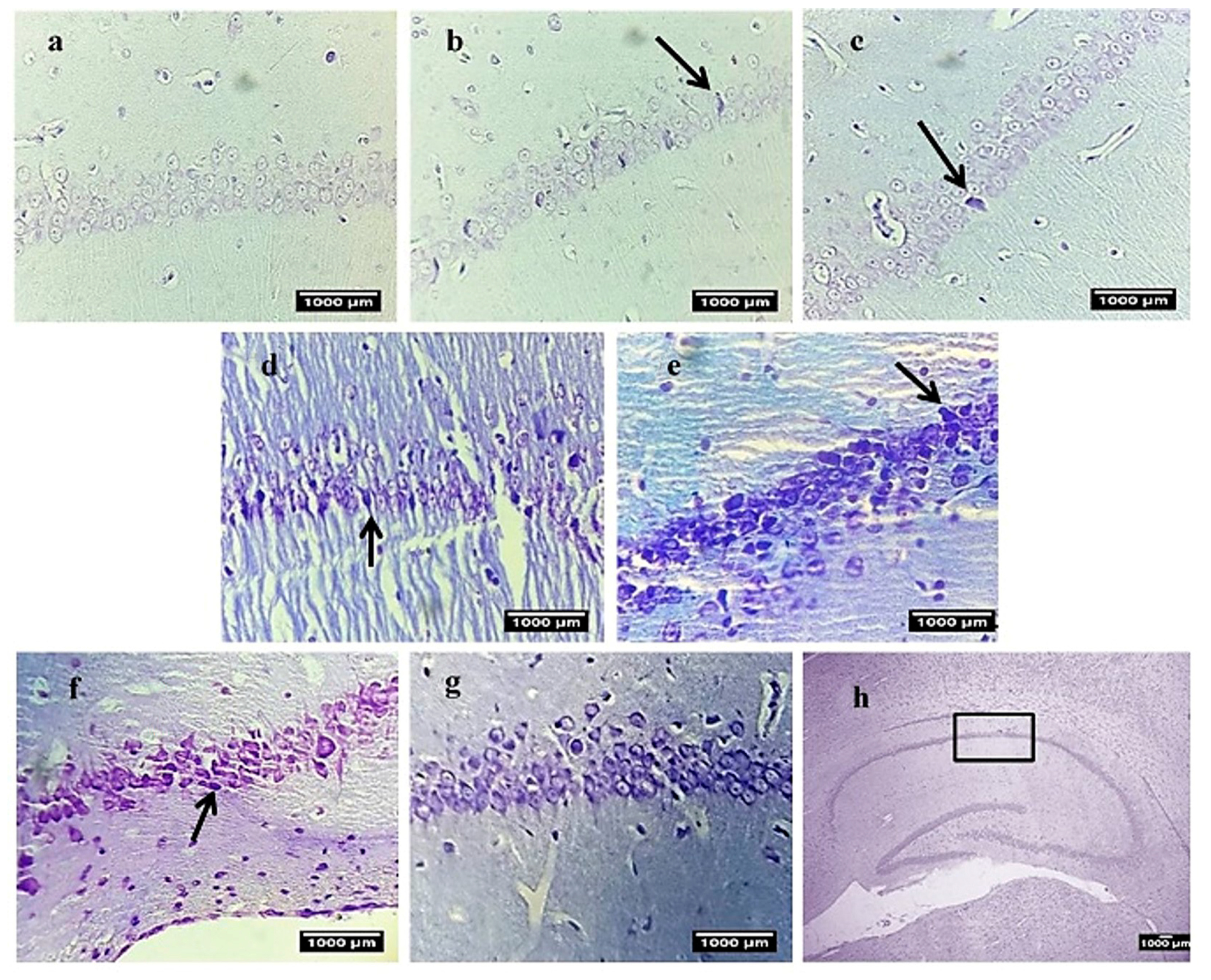 Brainsci 14 00656 g007b