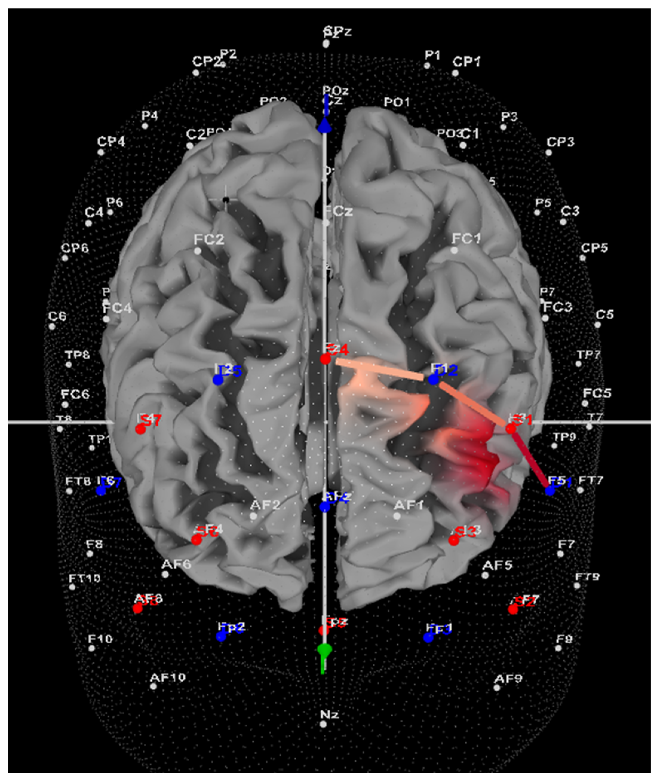 Brainsci 14 00719 g003