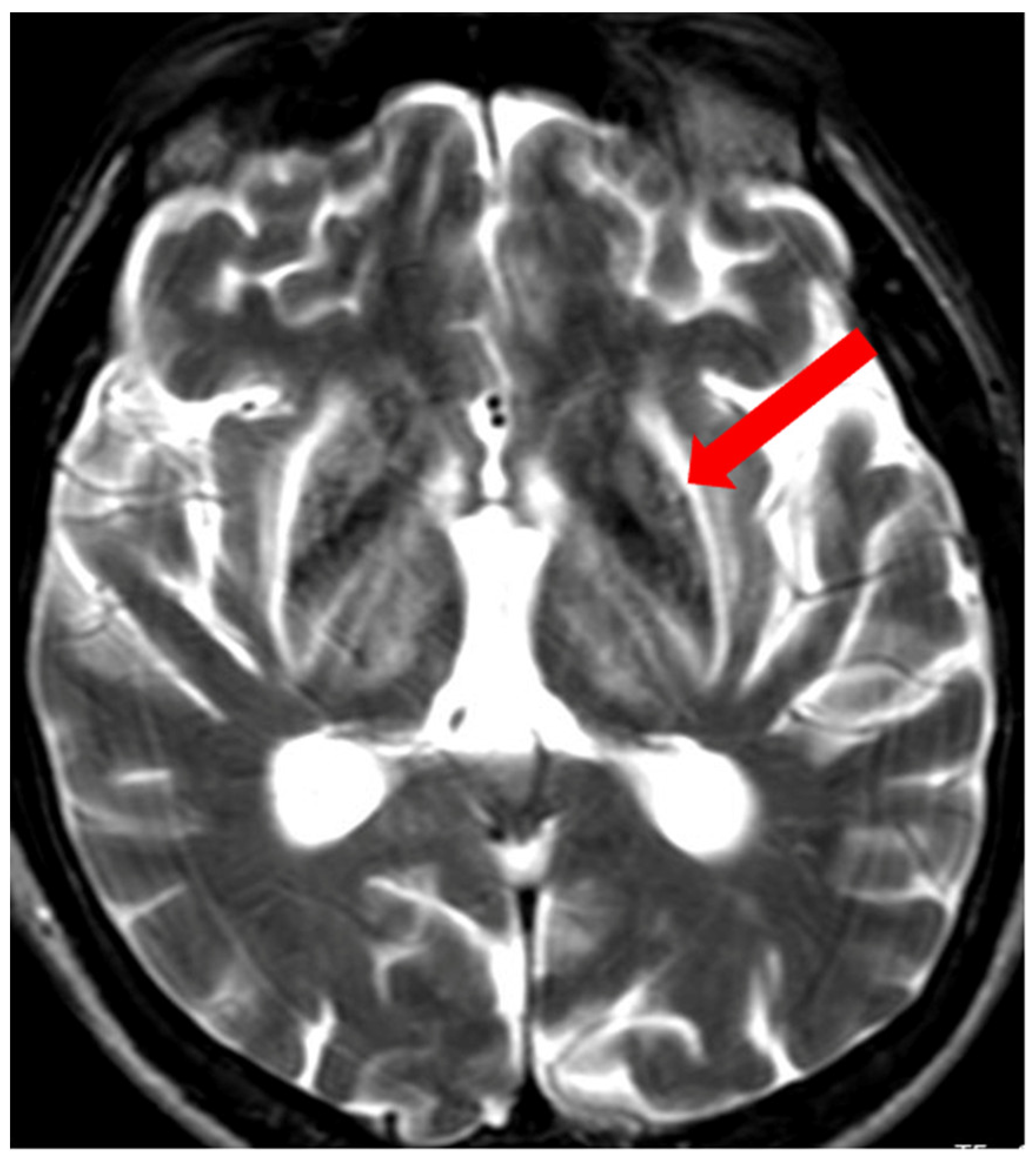 Brainsci 14 00727 g011