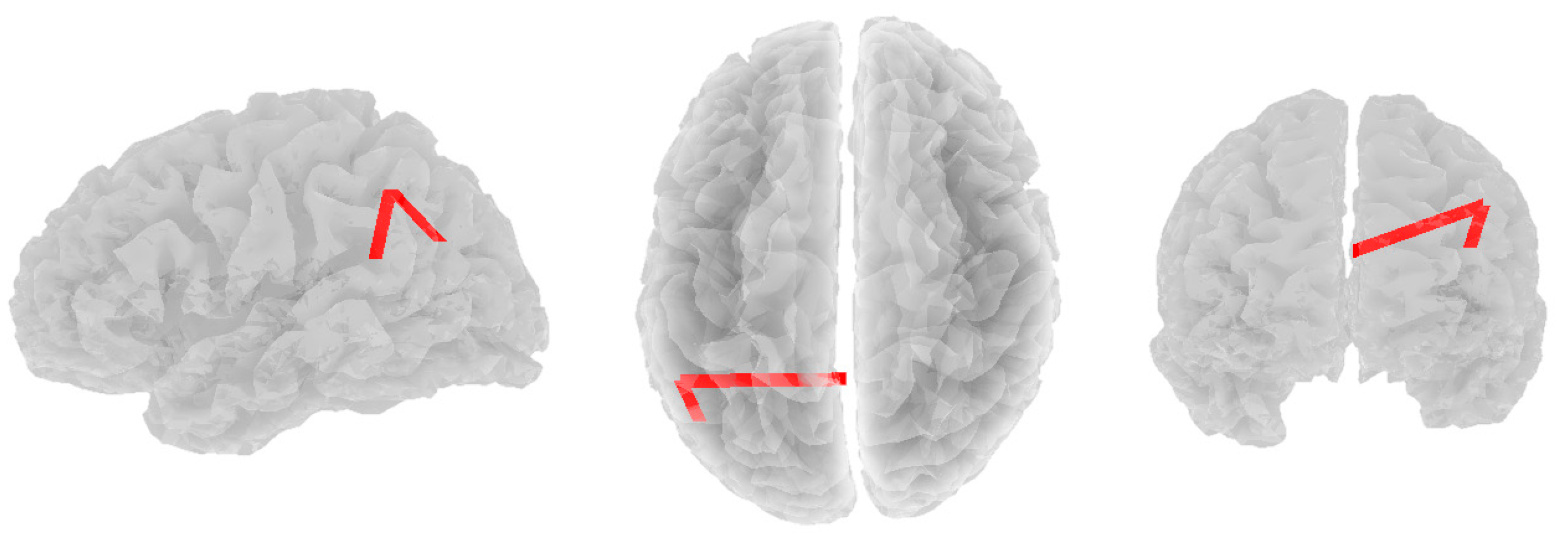Brainsci 14 00845 g005