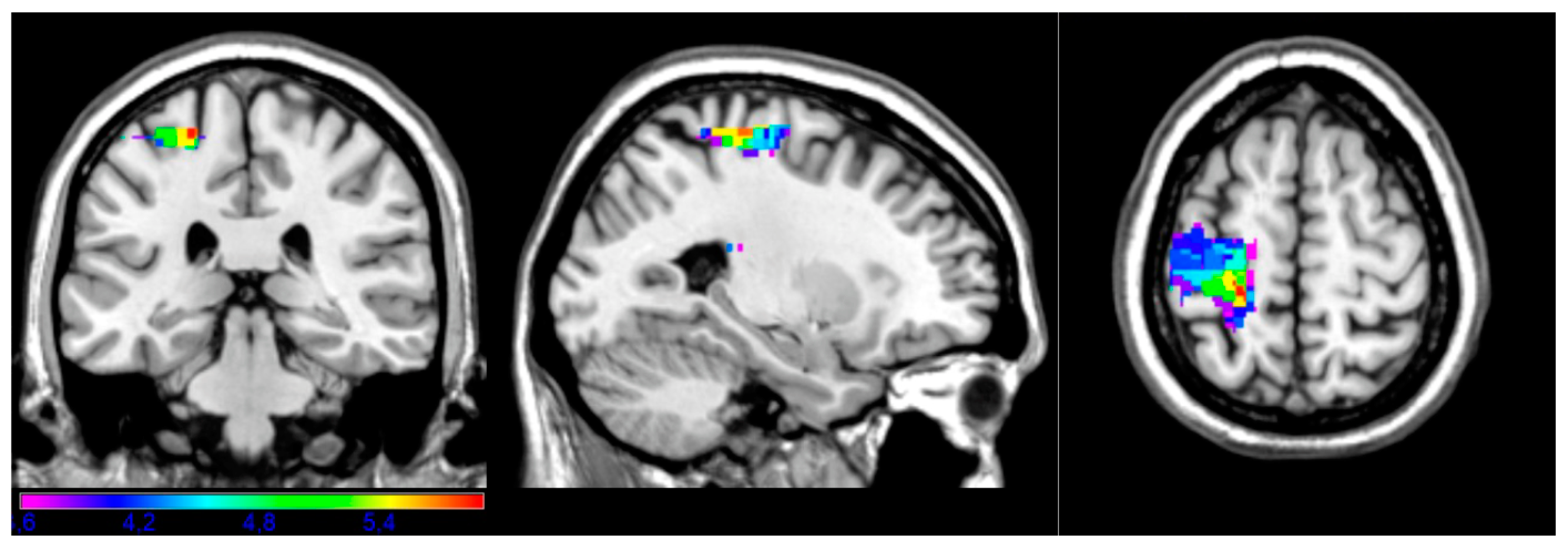 Brainsci 14 00853 g002 Brainsci 14 00853 g002