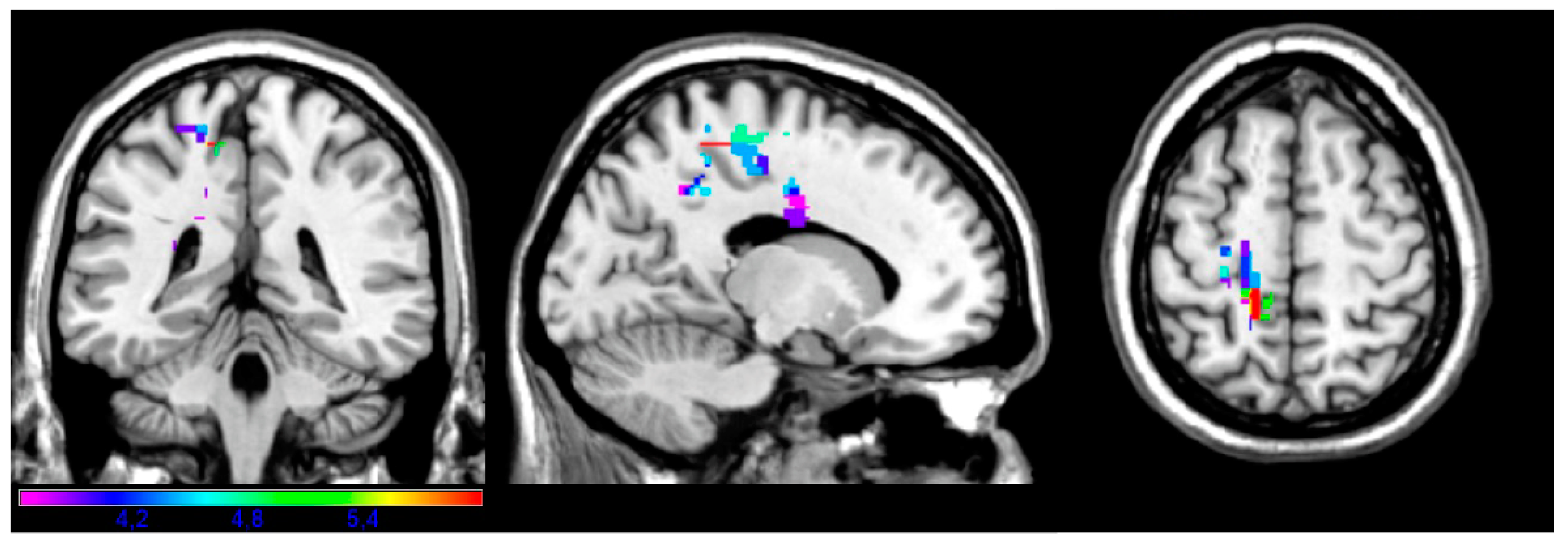 Brainsci 14 00853 g003 Brainsci 14 00853 g003