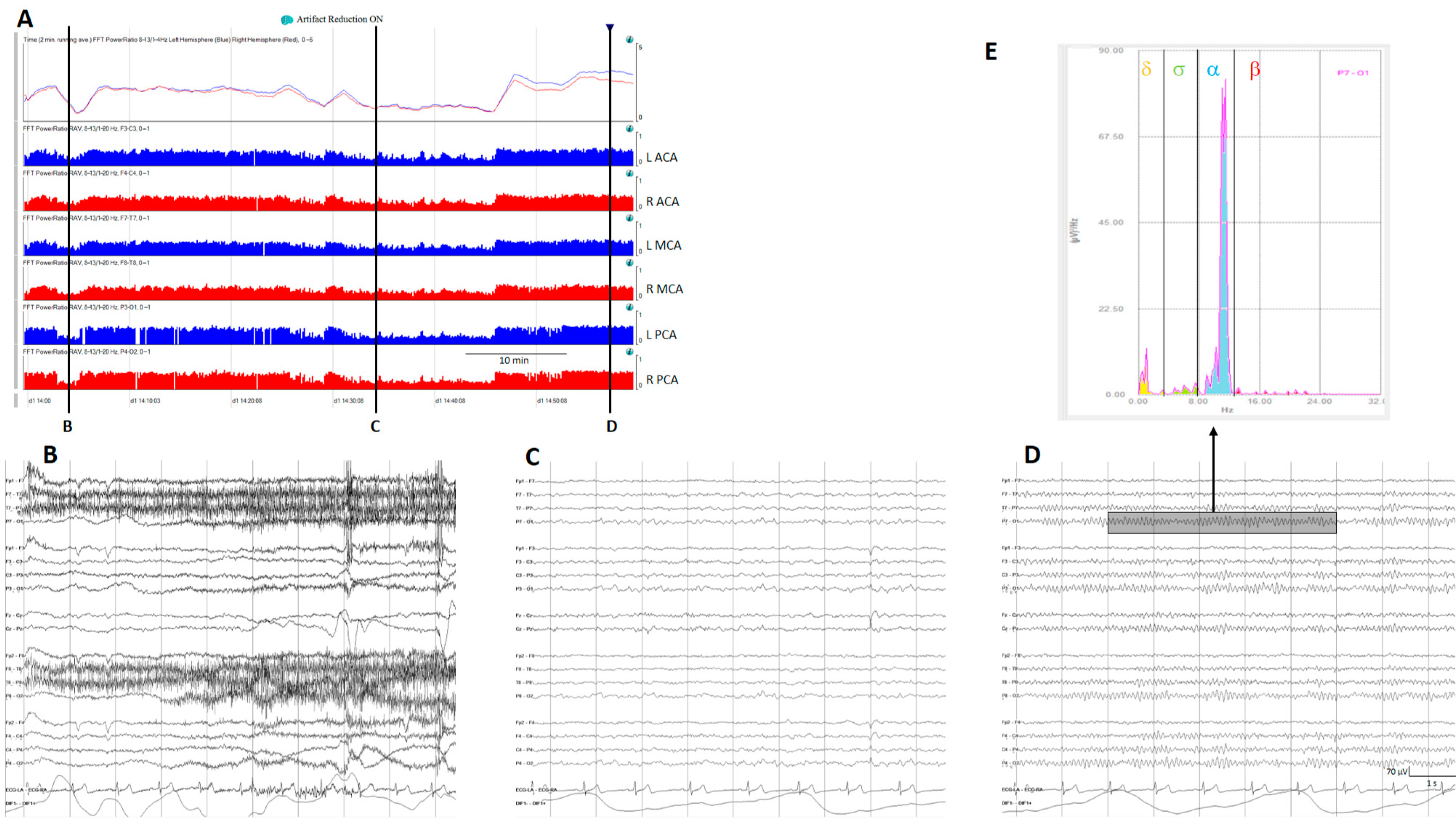 Brainsci 14 00939 g004