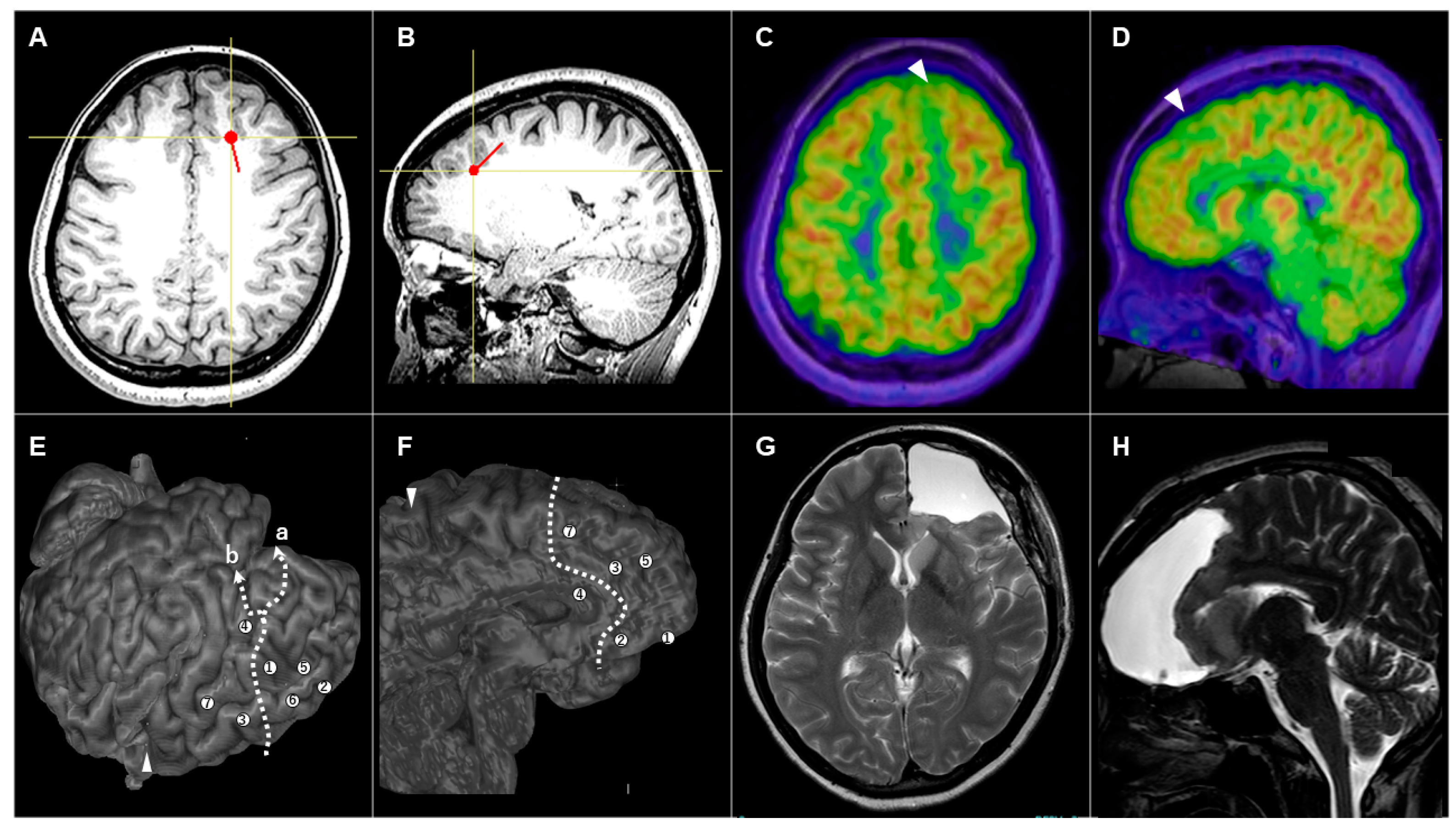 Brainsci 14 00958 g003