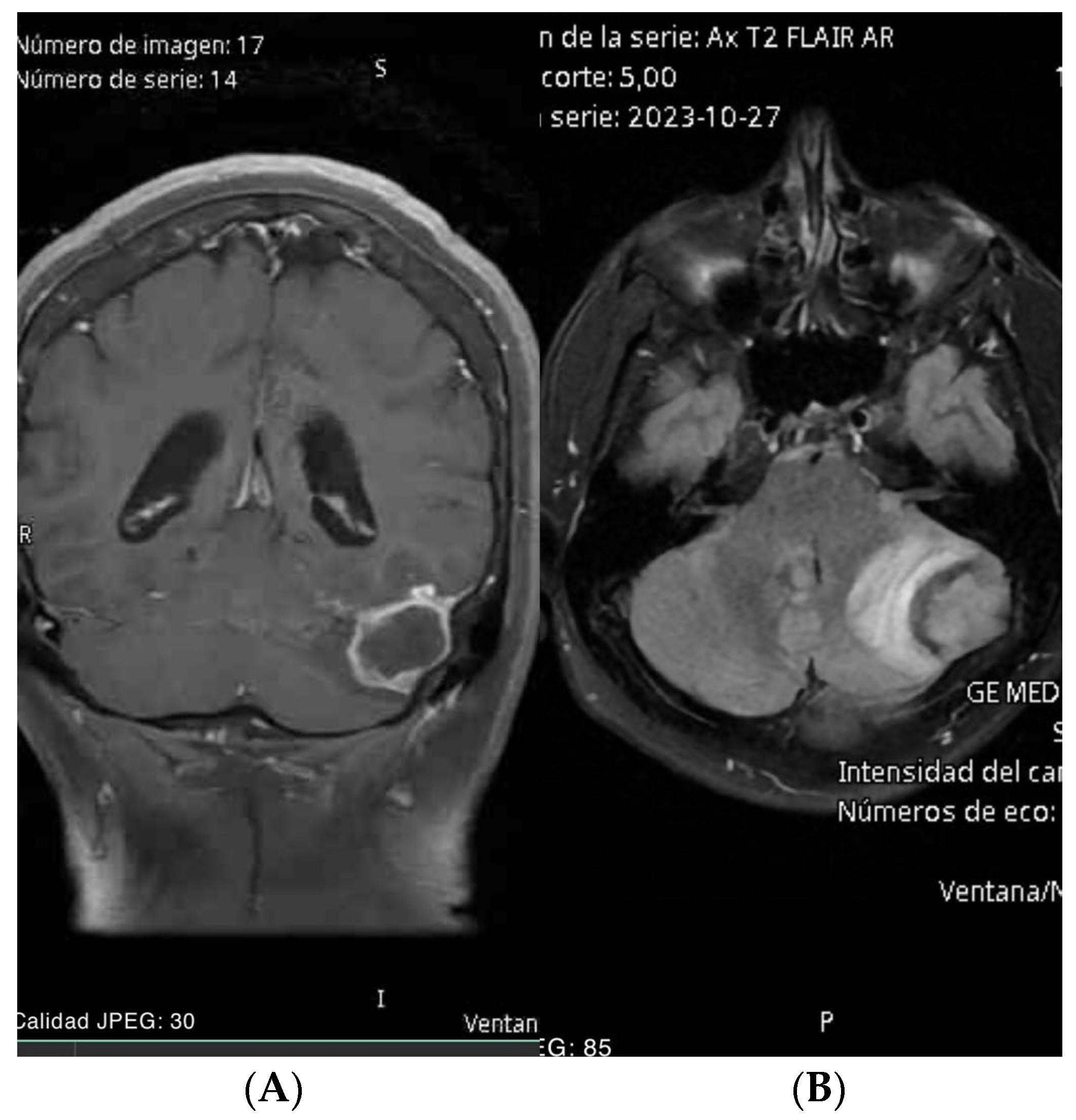 Brainsci 14 01025 g001