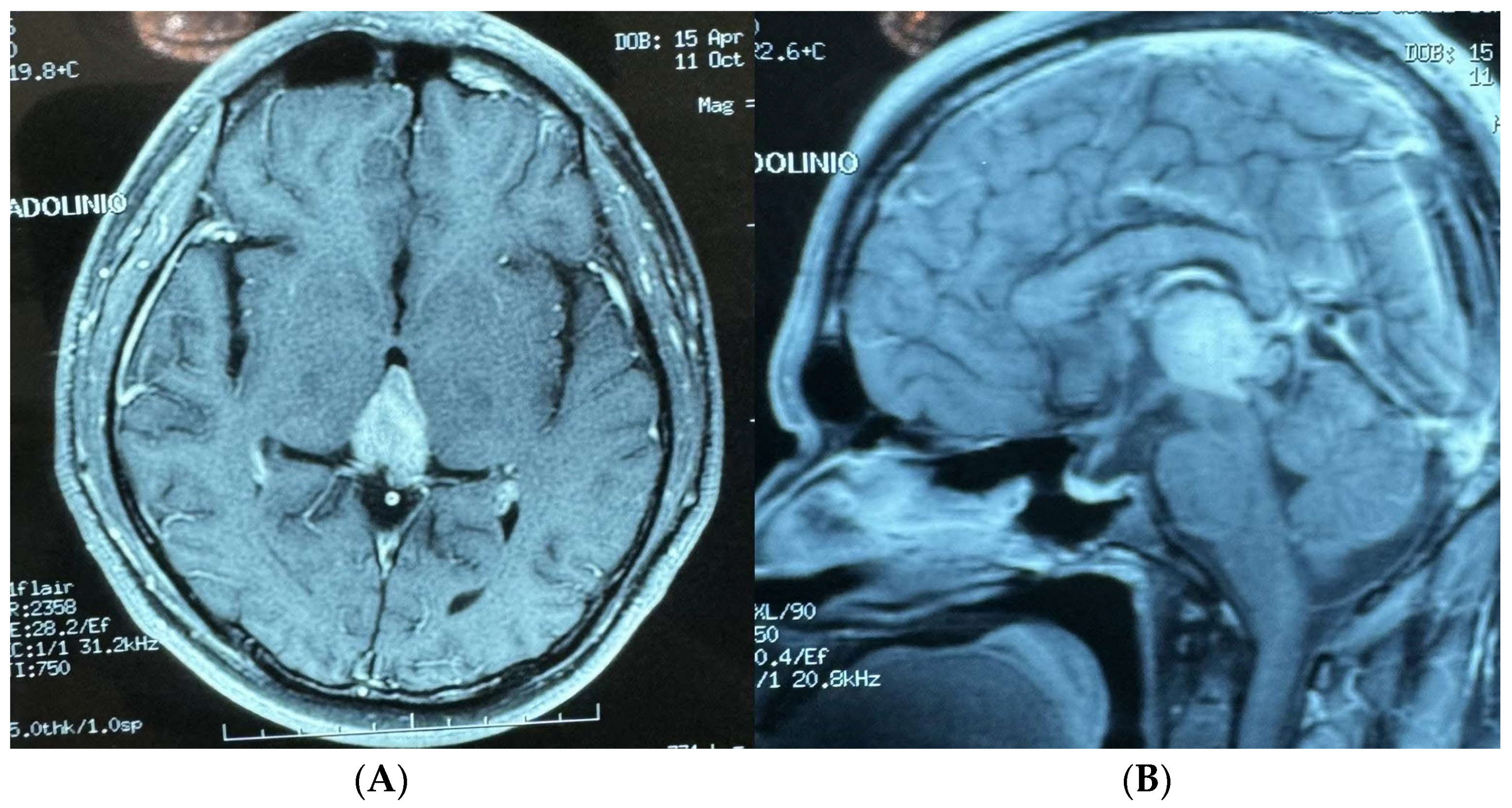 Brainsci 14 01025 g004