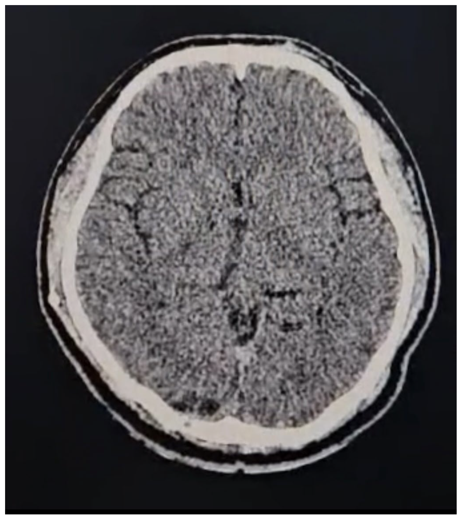 Brainsci 14 01025 g006