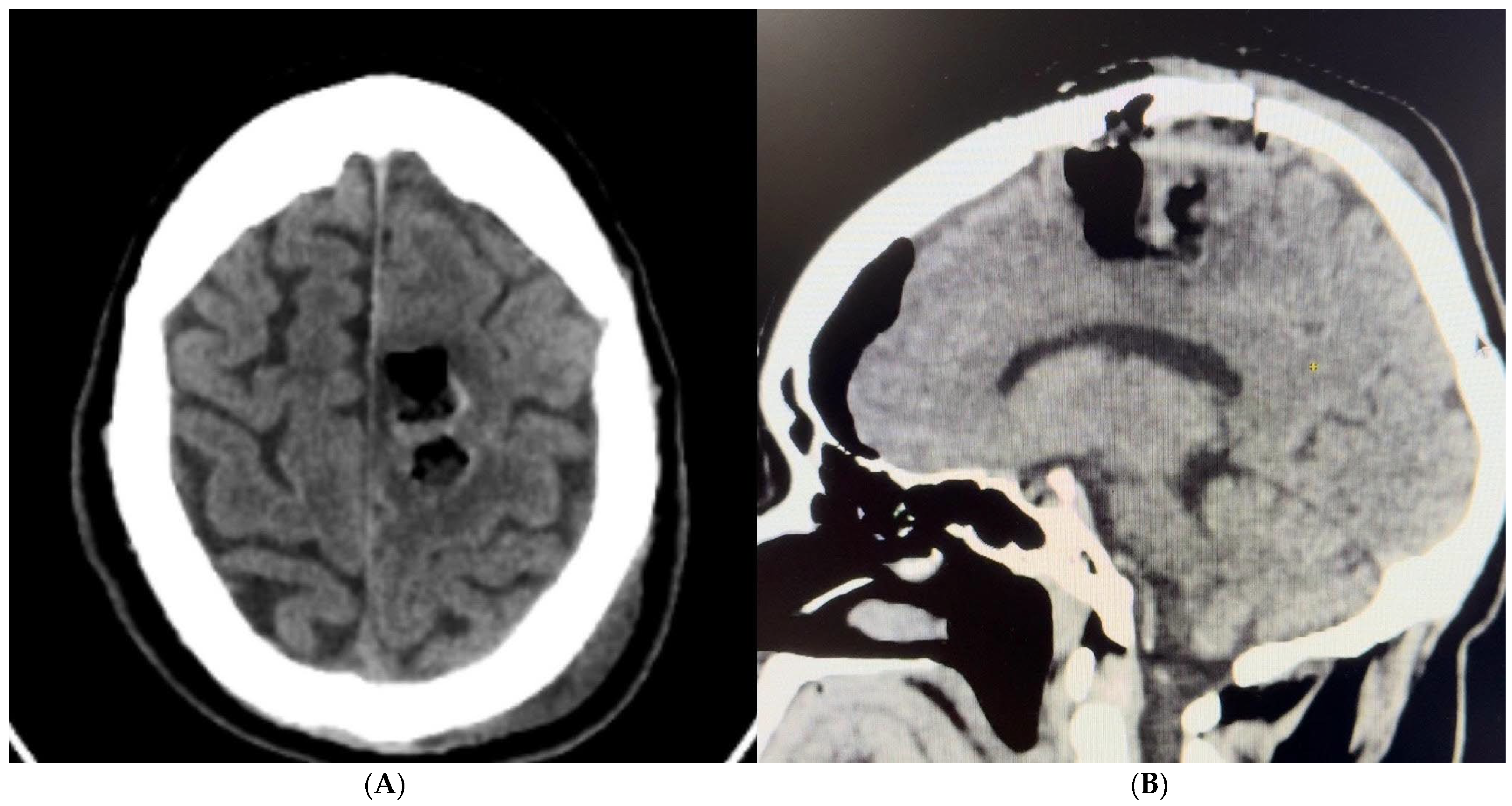 Brainsci 14 01025 g009