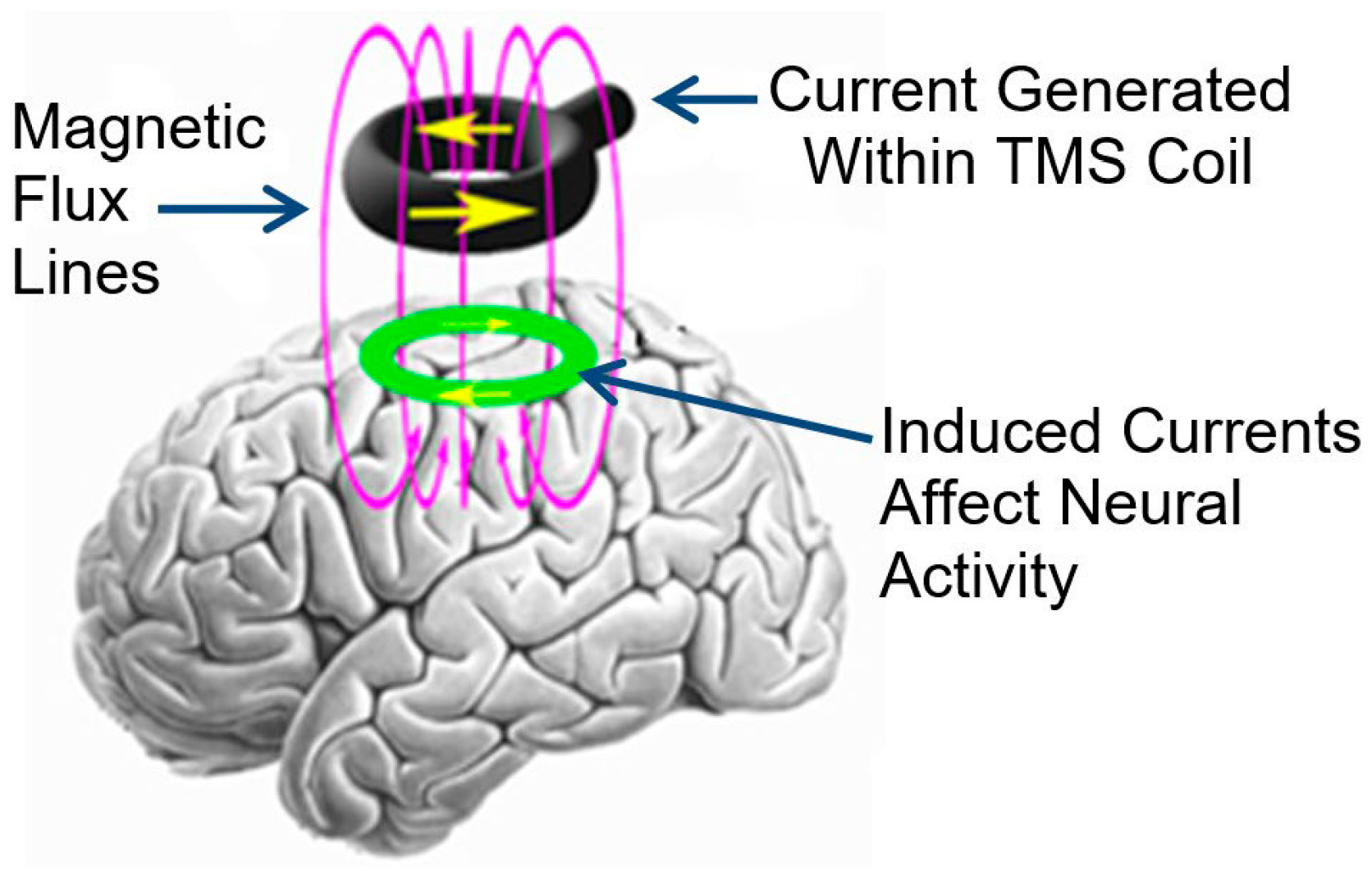 Brainsci 14 01092 g001