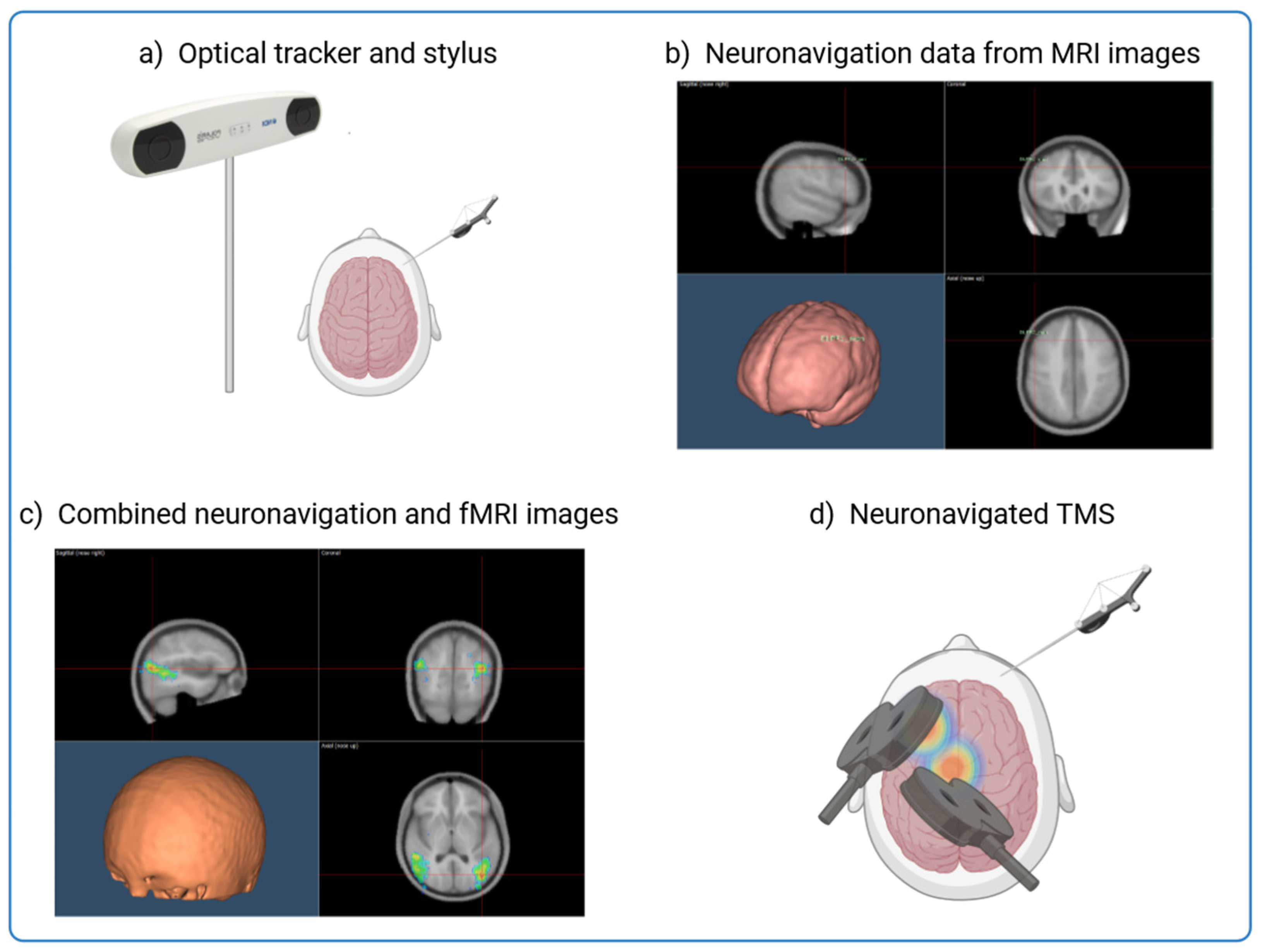 Brainsci 15 00237 g001