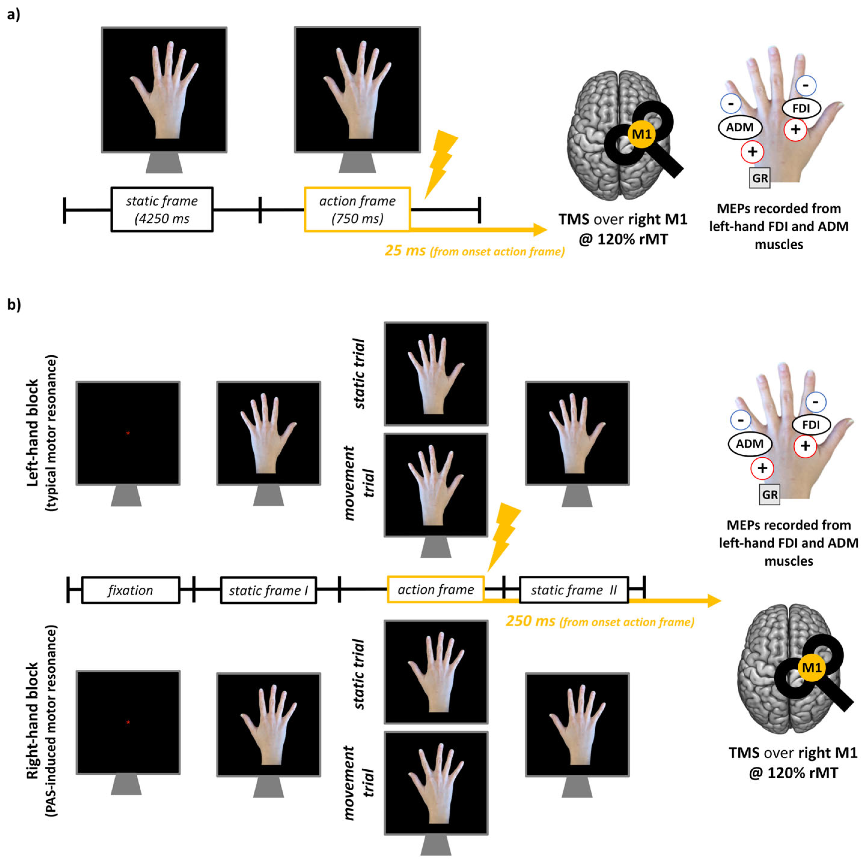 Brainsci 15 00257 g001