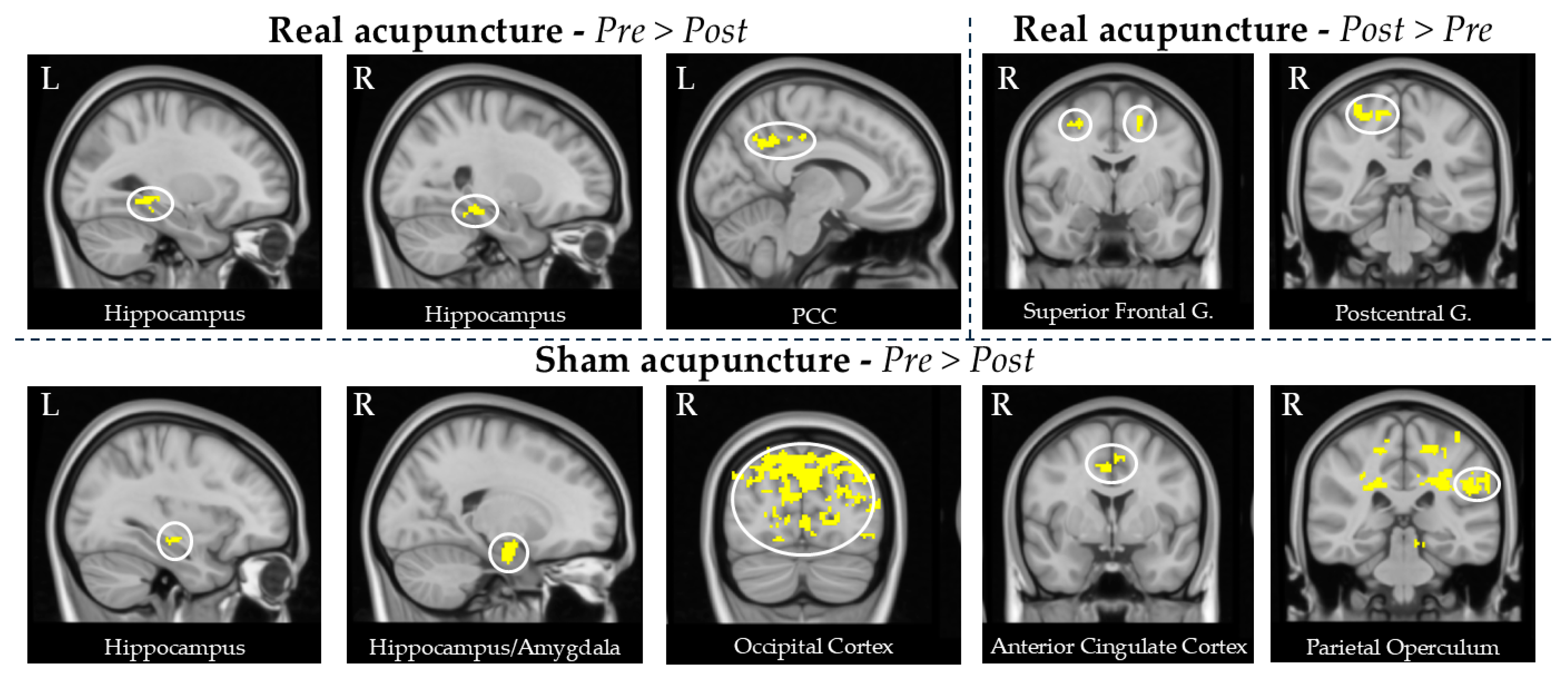 Brainsci 15 00261 g005