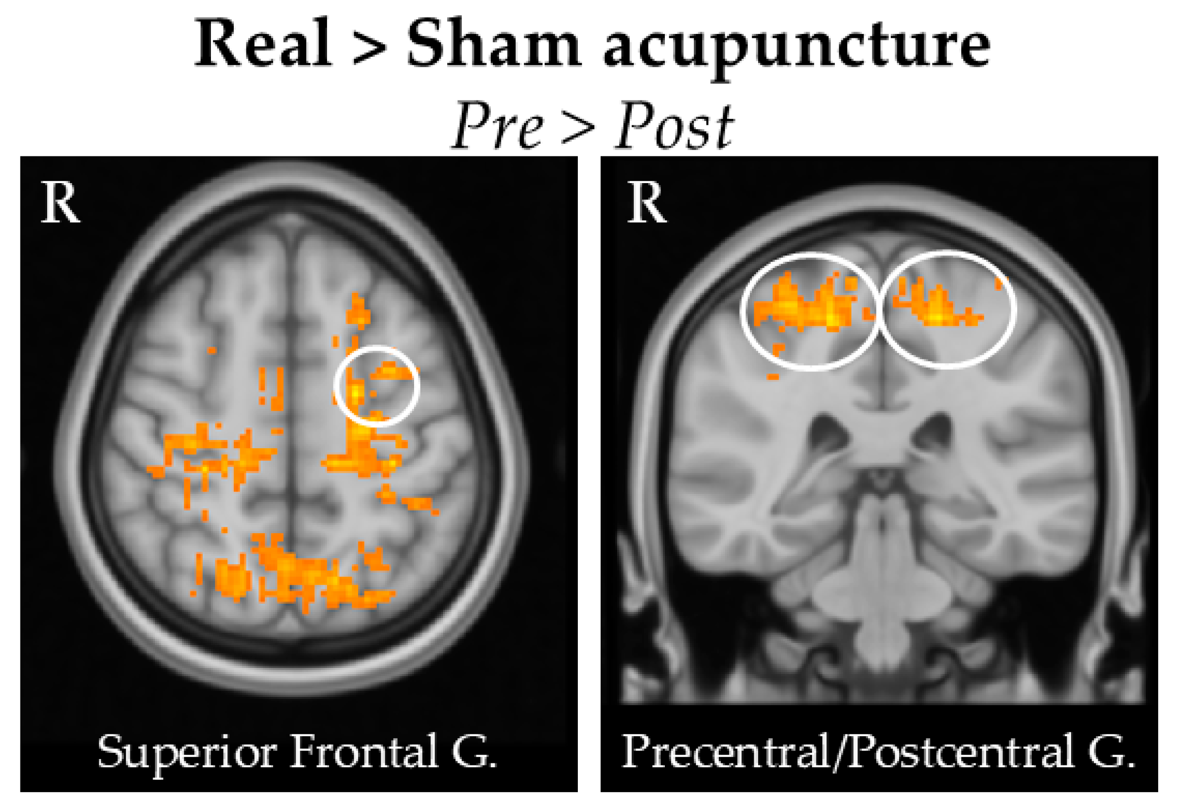 Brainsci 15 00261 g006