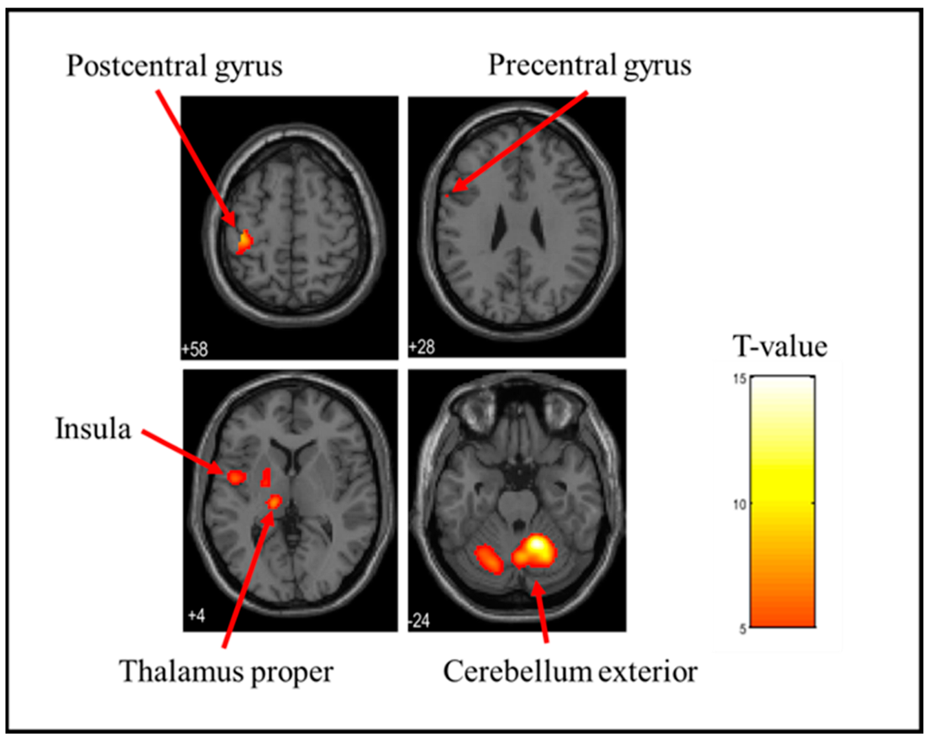 Brainsci 15 00264 g003