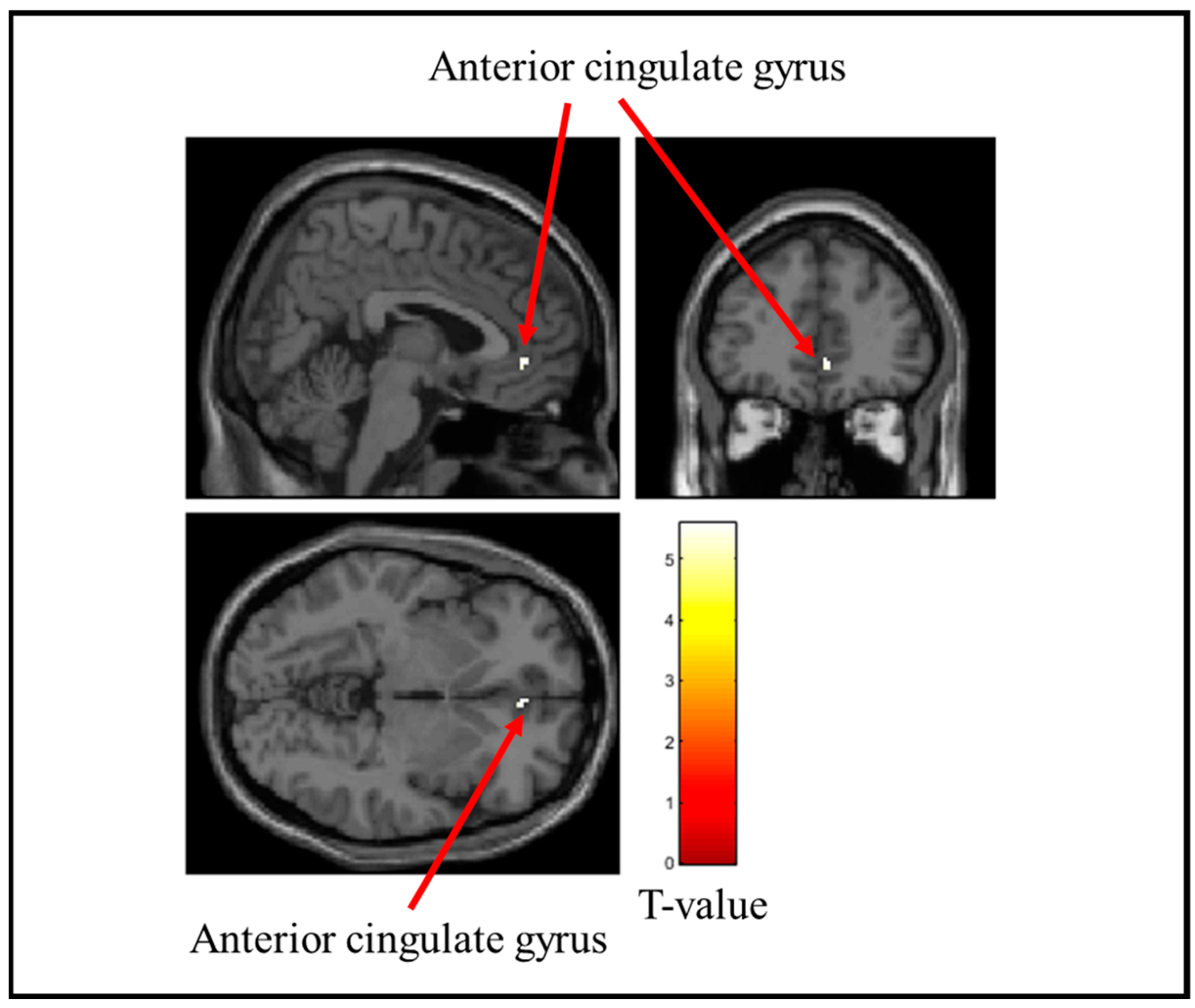 Brainsci 15 00264 g008