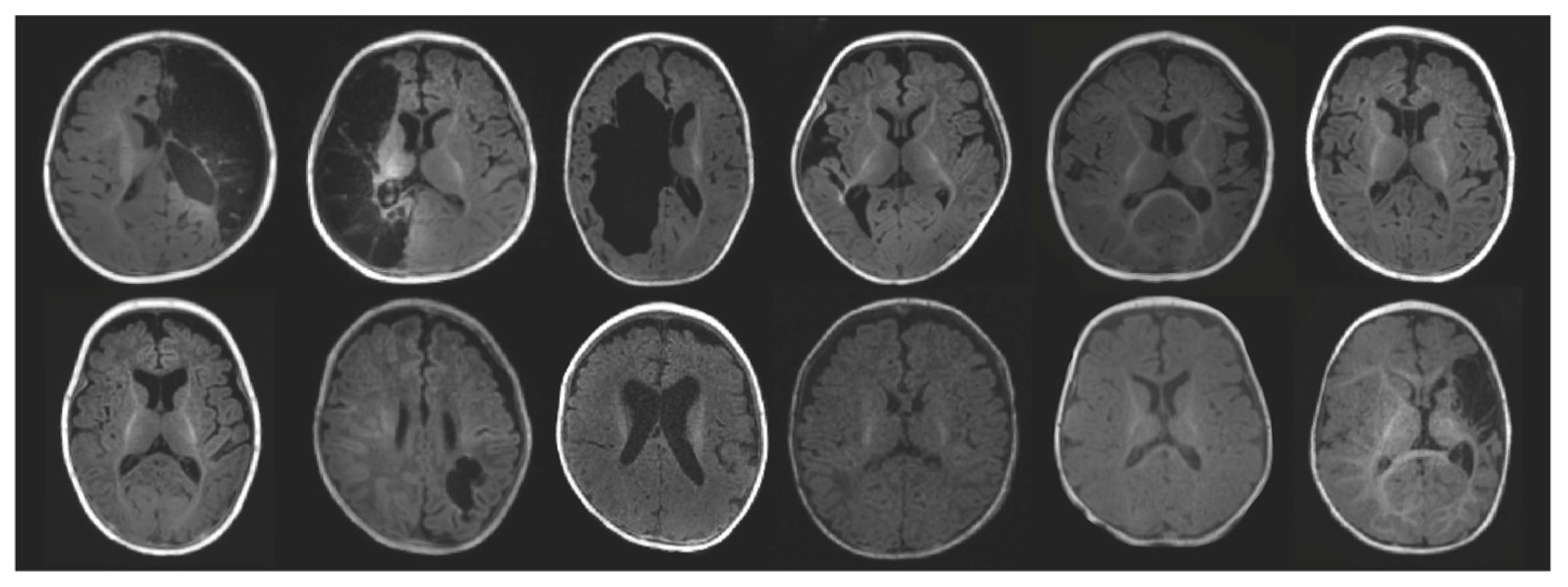 Brainsci 15 00341 g001