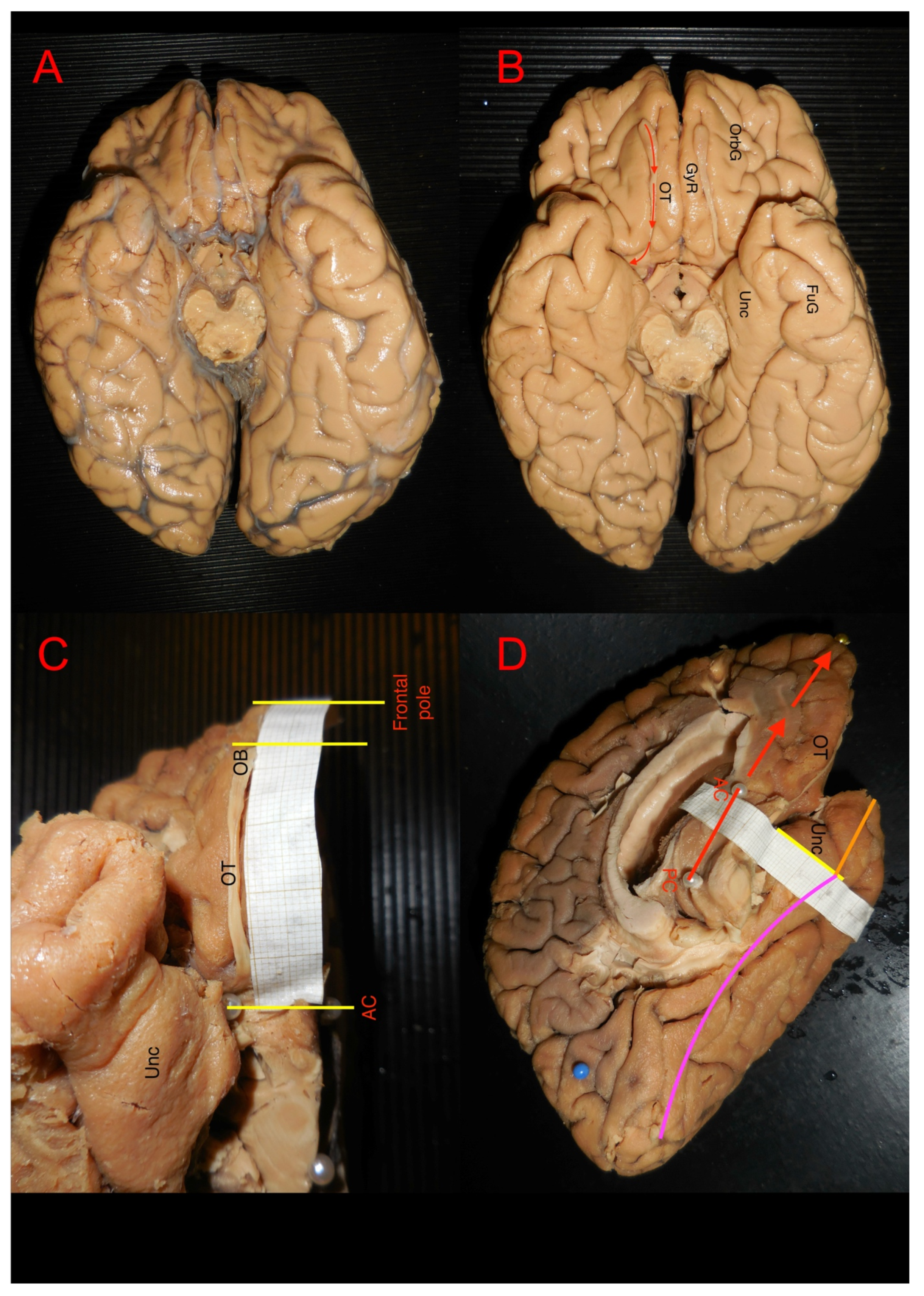 Brainsci 15 00368 g001