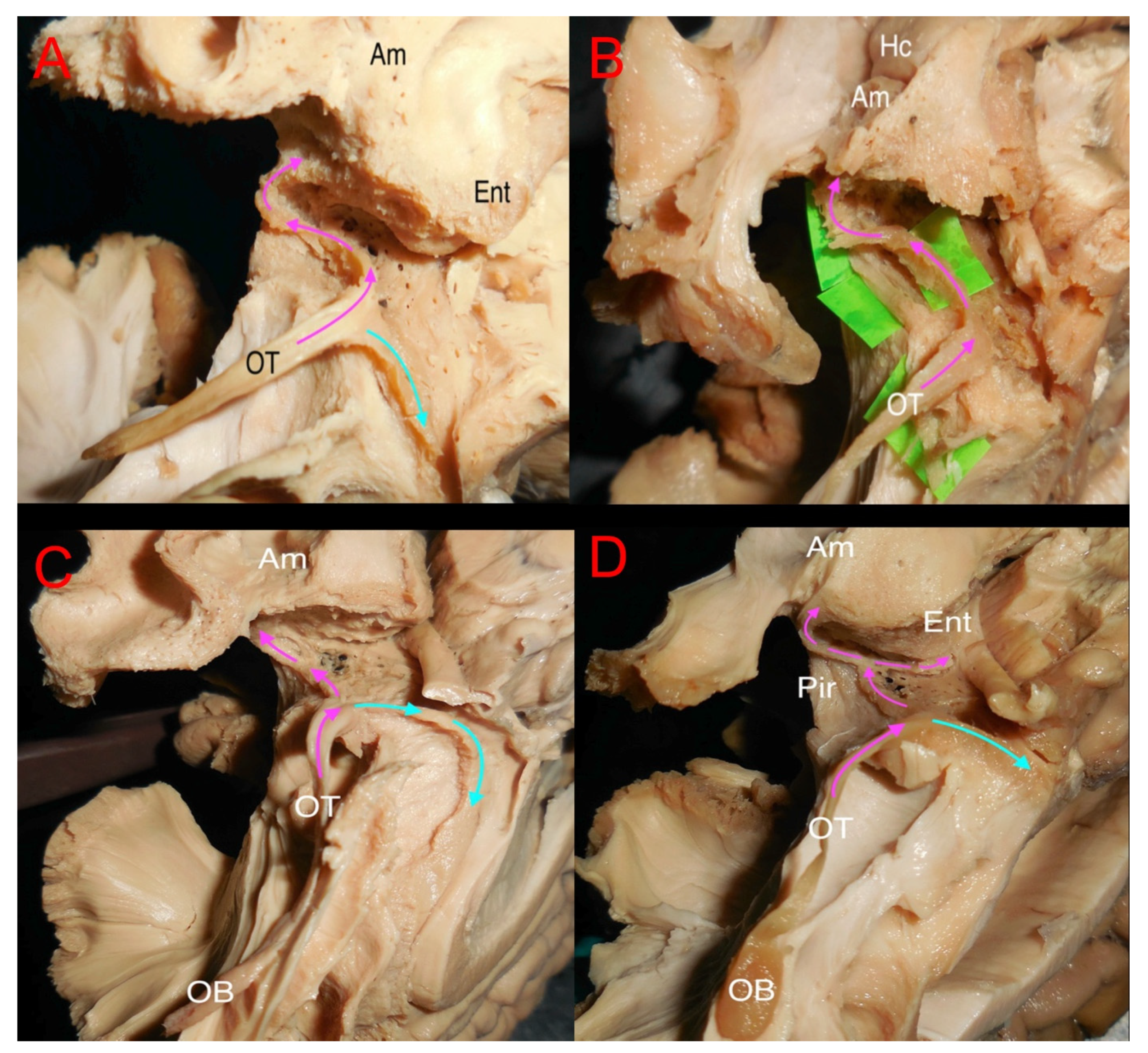 Brainsci 15 00368 g003