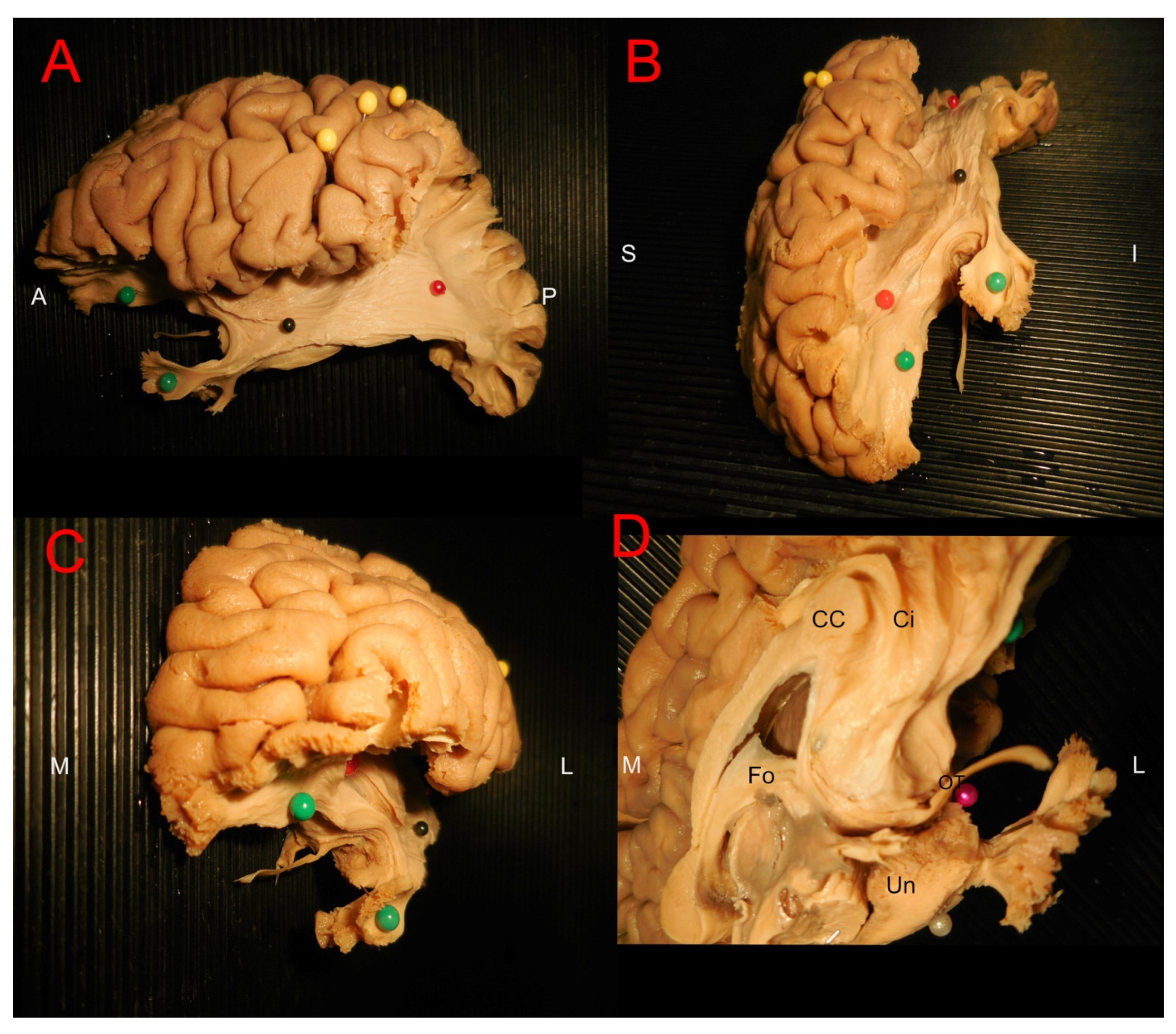 Brainsci 15 00368 g005