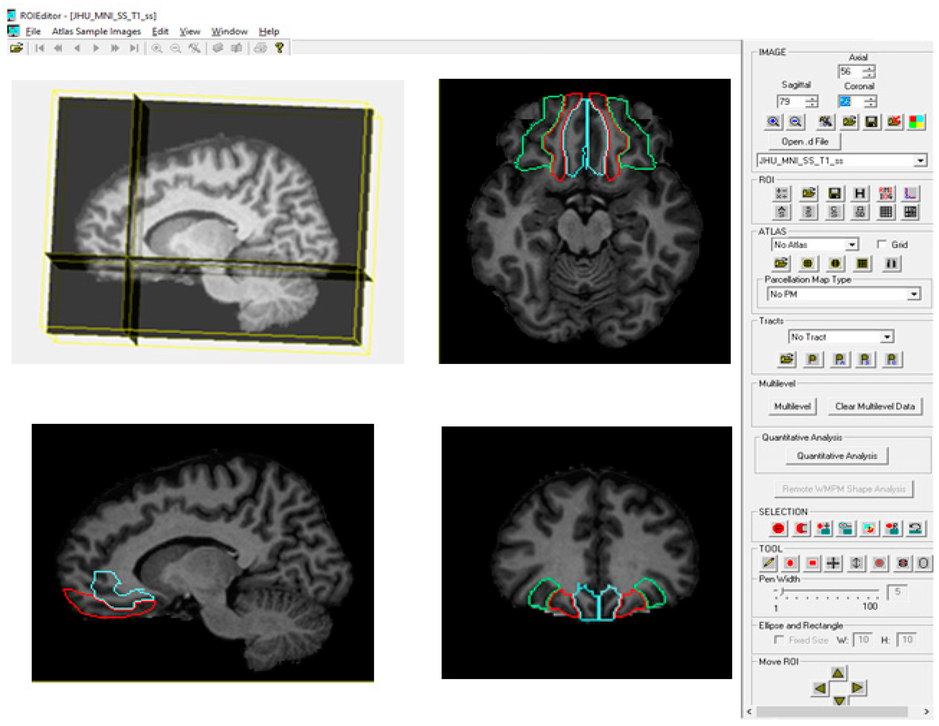 Brainsci 15 00452 g001