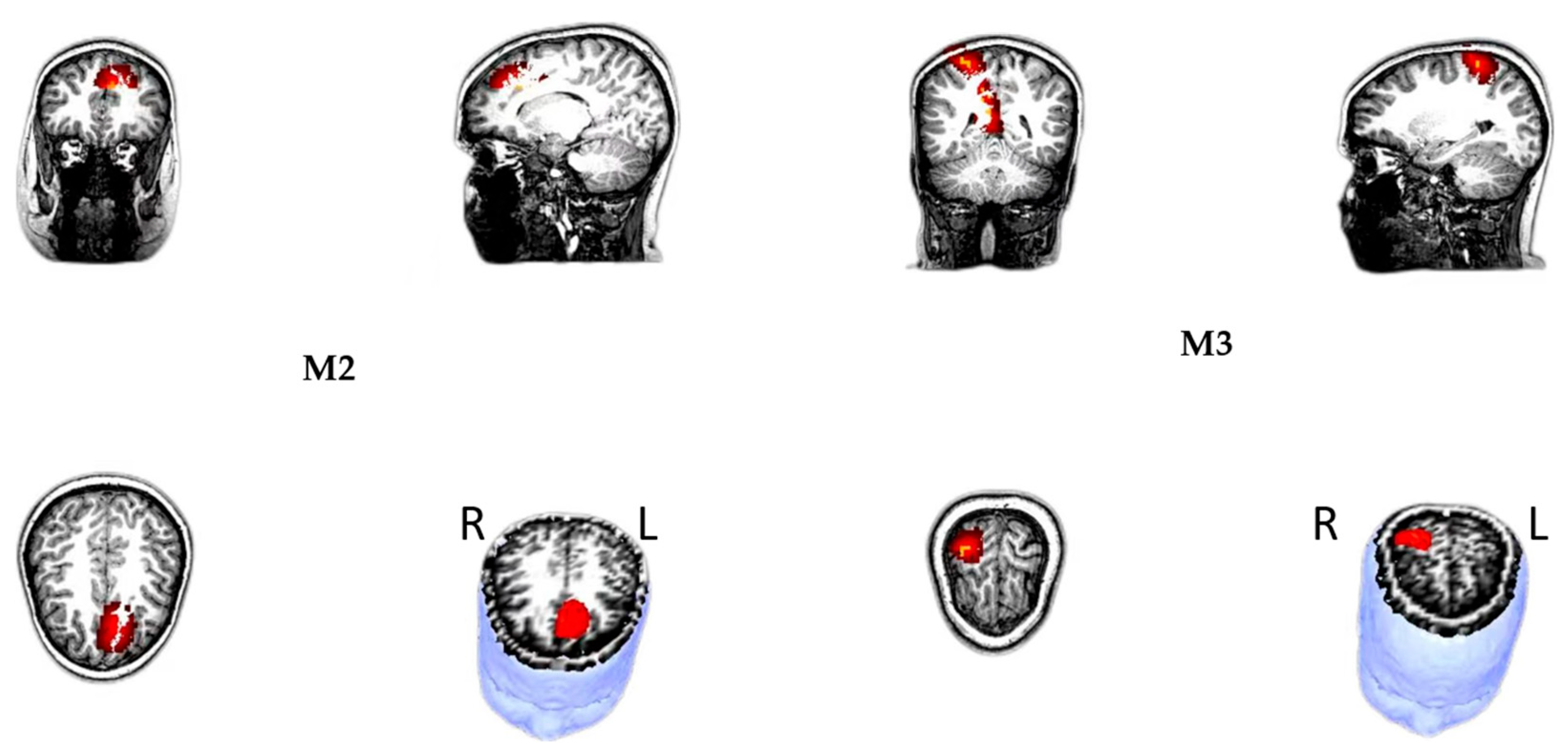 Brainsci 15 00624 g005 Brainsci 15 00624 g005