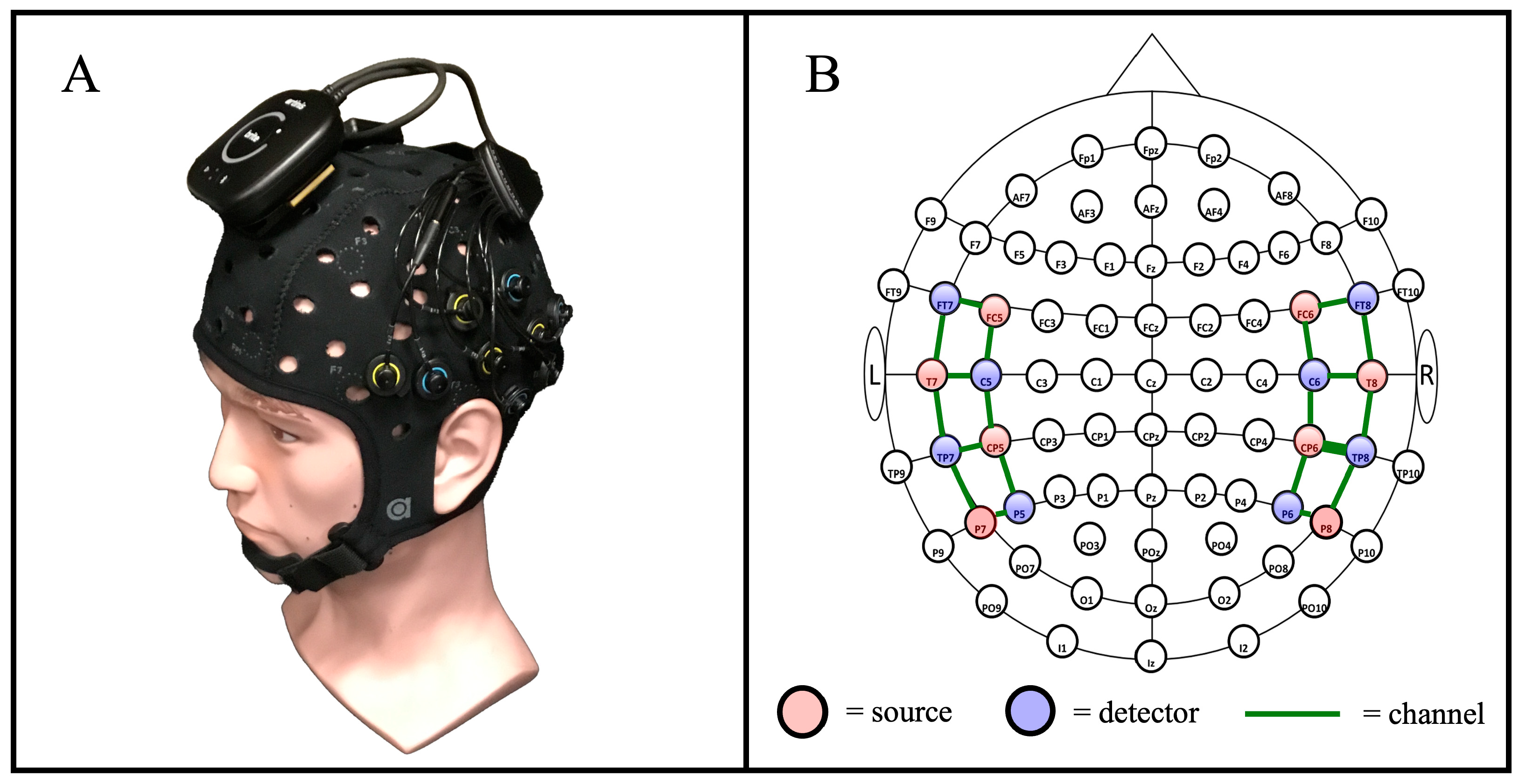 Brainsci 15 01172 g003 Brainsci 15 01172 g003