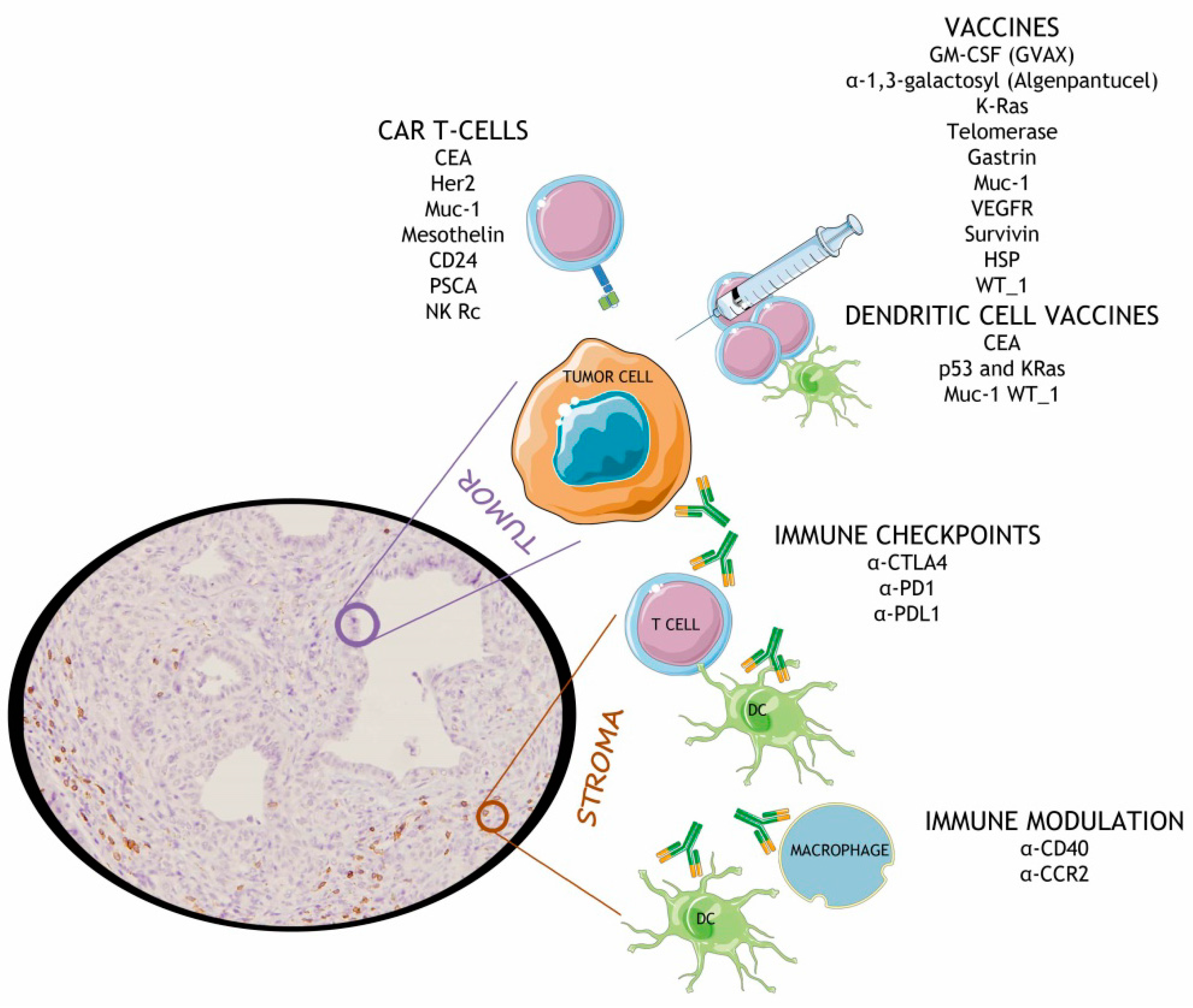 Cancers | Free Full-Text | Immune Evasion in Pancreatic Cancer: From  Mechanisms to Therapy