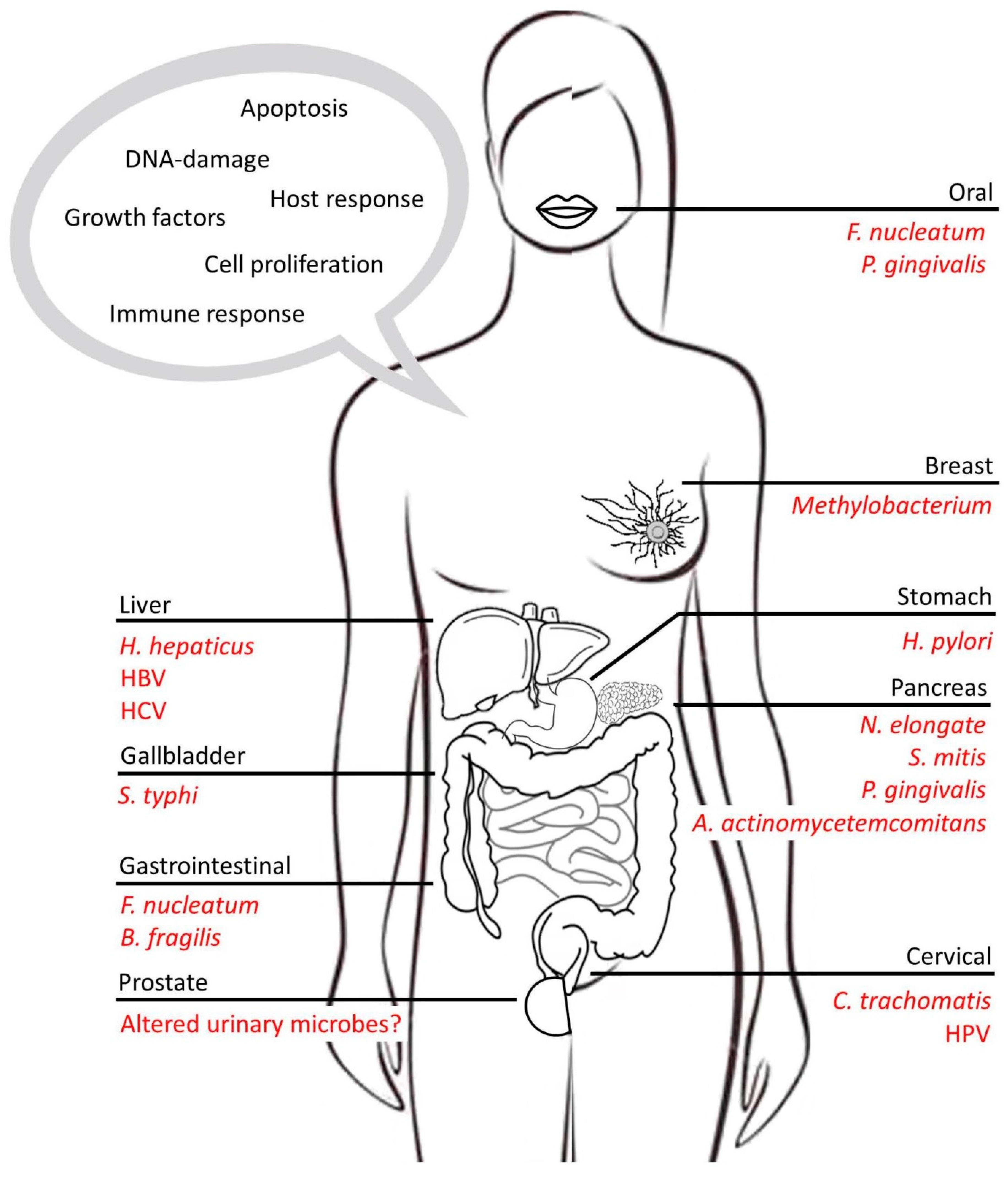 Cancers | Free Full-Text | The Complex Interplay between Chronic  Inflammation, the Microbiome, and Cancer: Understanding Disease Progression  and What We Can Do to Prevent It